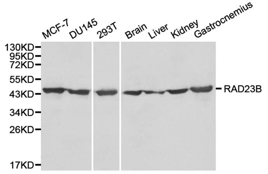 Western blot analysis of MCF-7,DU145,293T,Brain,Liver,Kidney,Gastrocnemius cell line lysates using RAD23B antibody