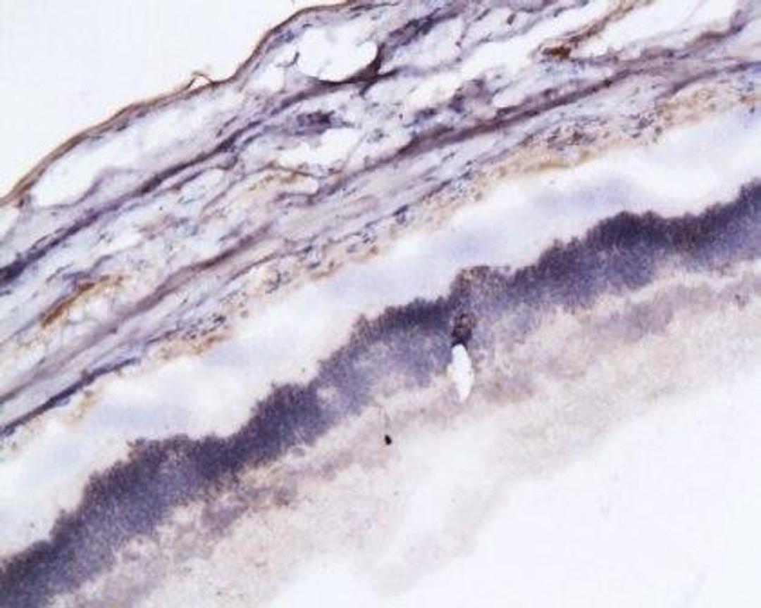 Immunohistochemical staining of paraffin embedded rat eyeball tissue using Occludin antibody