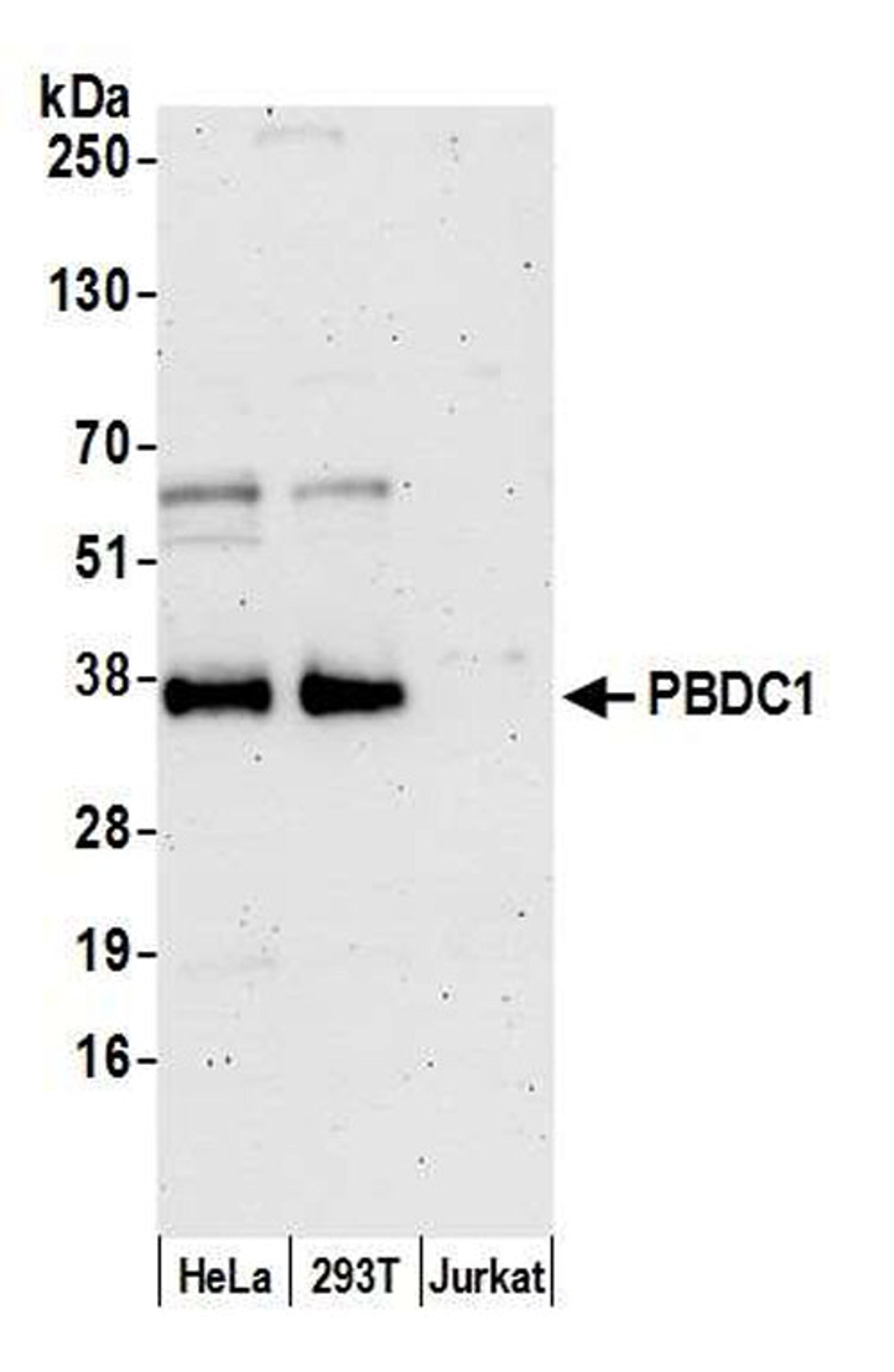 Detection of human PBDC1 by WB.