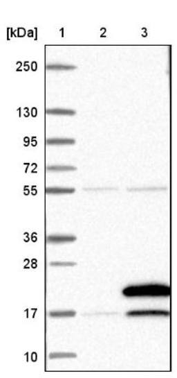 Western Blot: TBCA Antibody [NBP1-86288] - Lane 1: Marker [kDa] 250, 130, 95, 72, 55, 36, 28, 17, 10<br/>Lane 2: Negative control (vector only transfected HEK293T lysate)<br/>Lane 3: Over-expression lysate (Co-expressed with a C-terminal myc-DDK tag (~3.1 kDa) in mammalian HEK293T cells, LY417869)