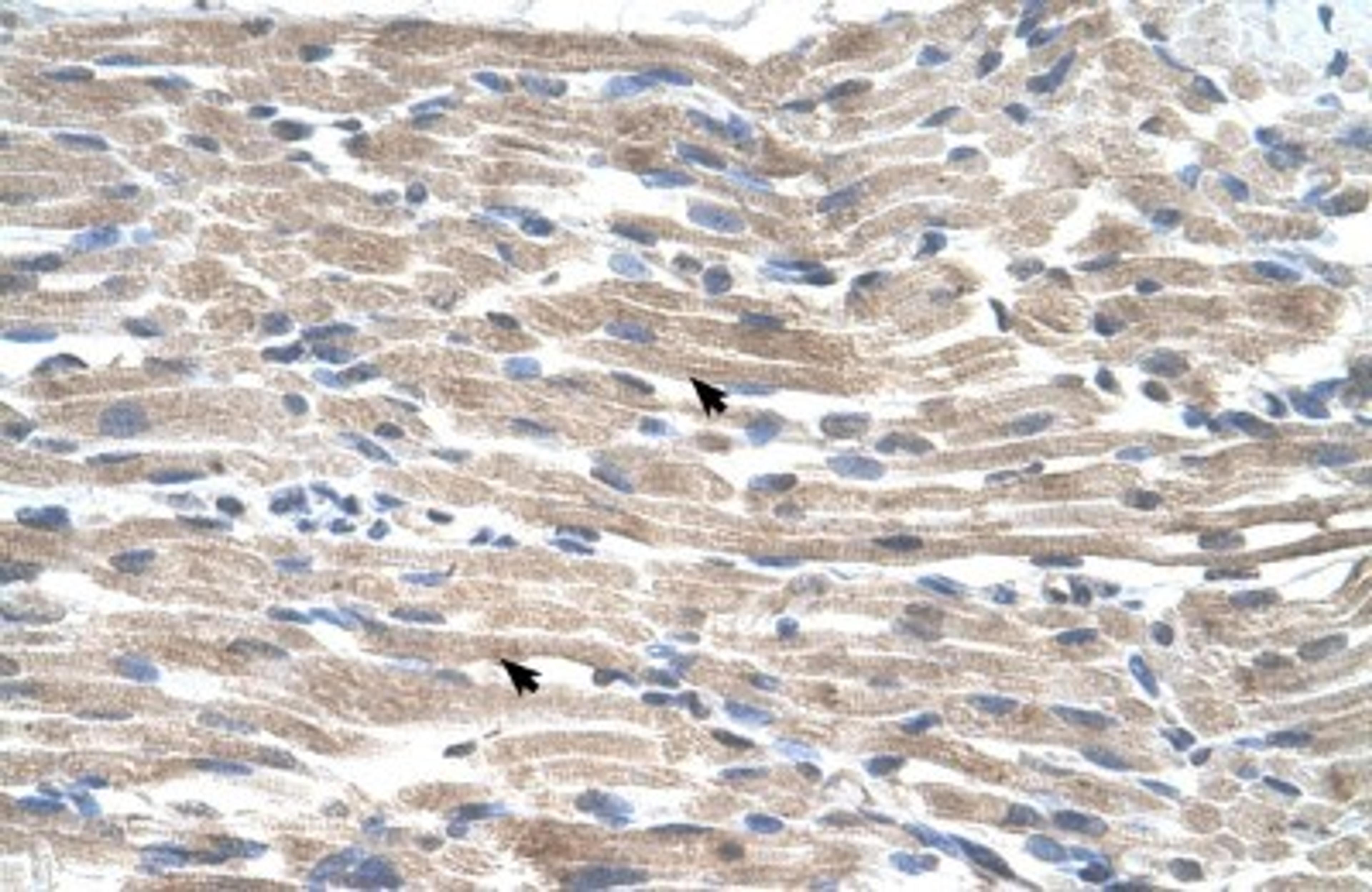 Immunohistochemistry-Paraffin: BMP2K Antibody [NBP1-52901] - Human Muscle Tissue, Skeletal muscle cells (Indicated with Arrows) 4-8ug/ml.