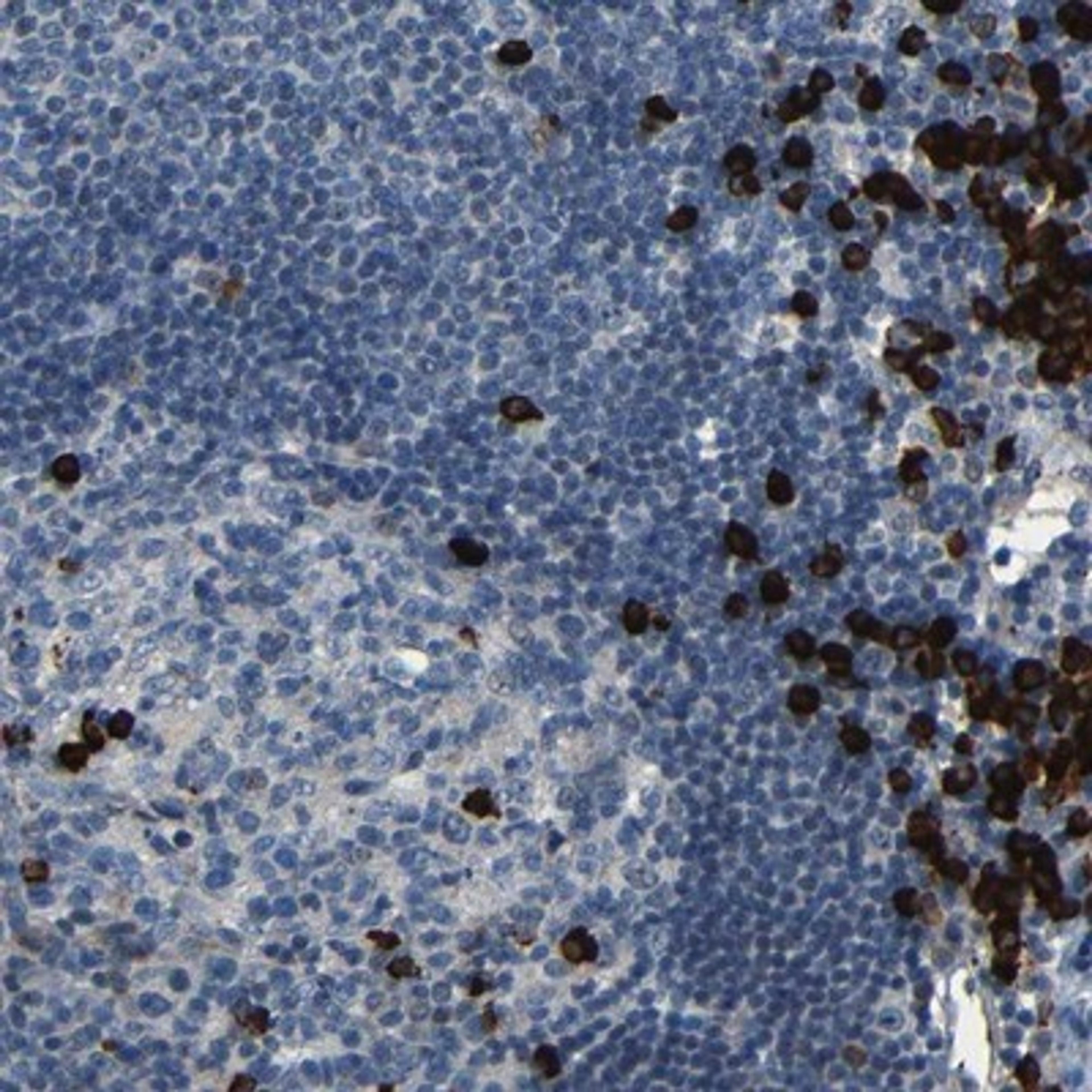 Immunohistochemistry-Paraffin: PLA2R1 Antibody [NBP1-84449] - Staining of human lymph node shows strong cytoplasmic positivity in a subset of cells.