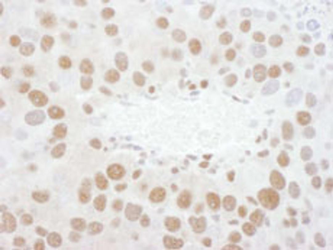 Detection of mouse TDP43 by immunohistochemistry.