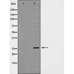 Western blot analysis of mouse liver using C1QB antibody