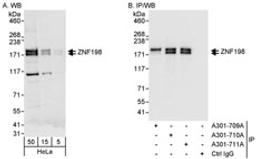 Detection of human ZNF198 by western blot and immunoprecipitation.