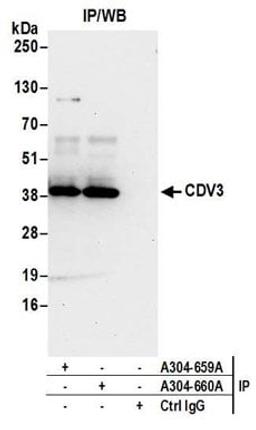 Detection of human CDV3 by western blot of immunoprecipitates.