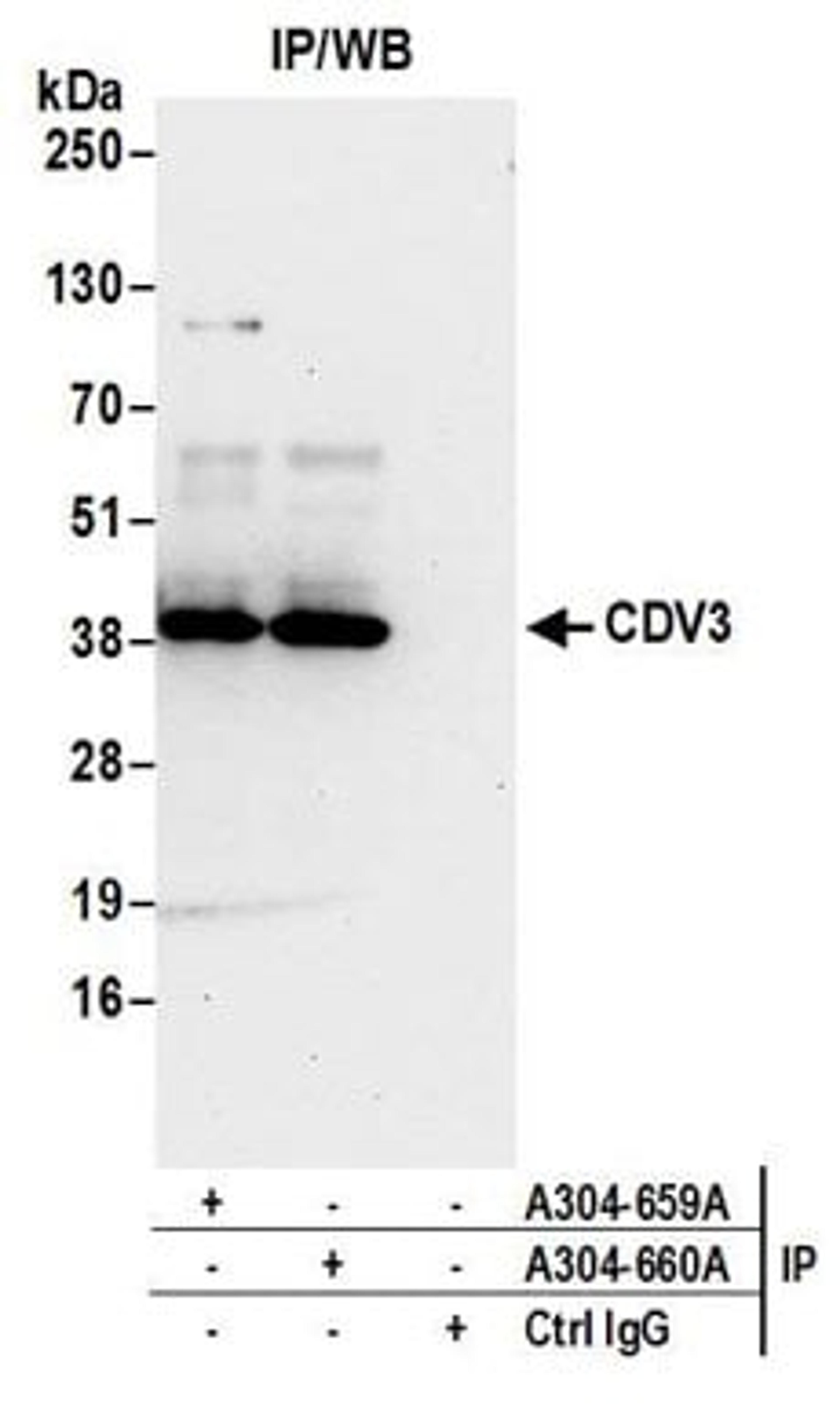 Detection of human CDV3 by western blot of immunoprecipitates.