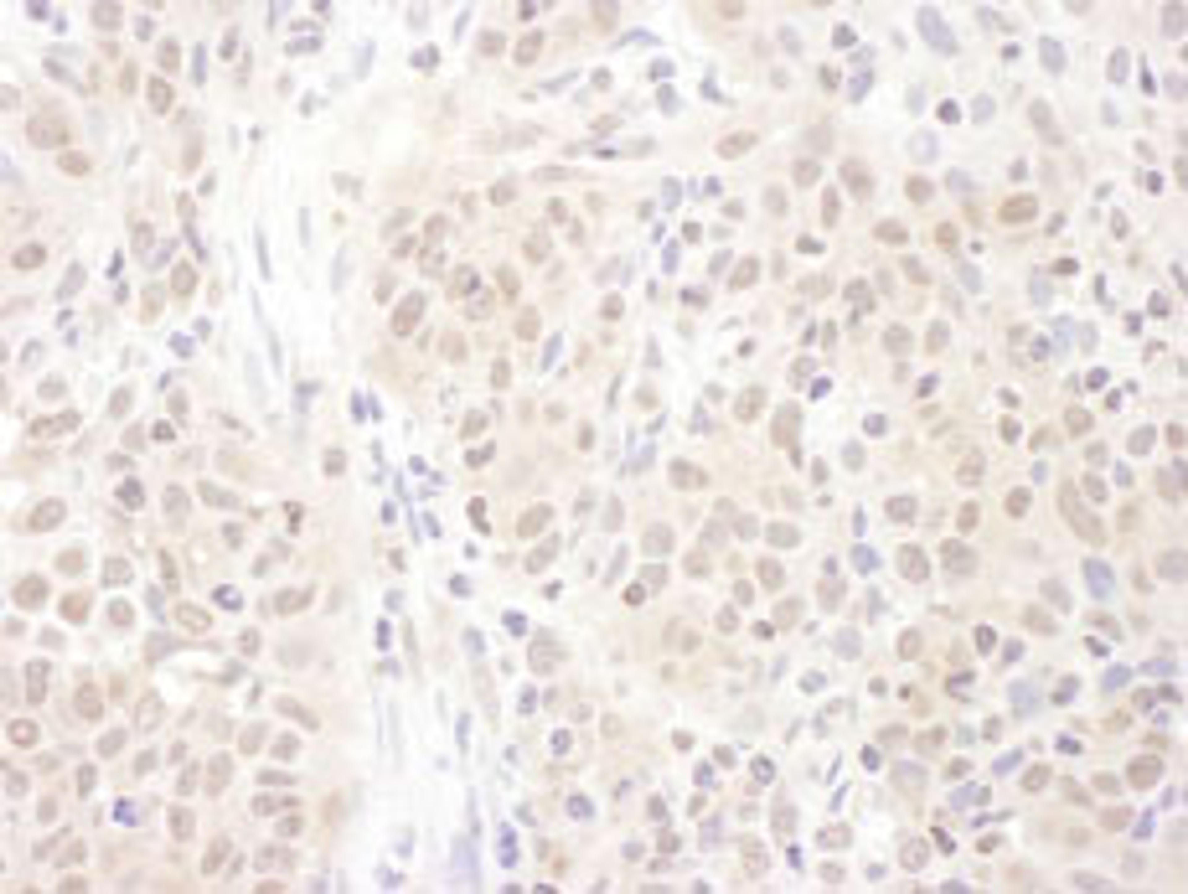 Detection of human PSME4 by immunohistochemistry.