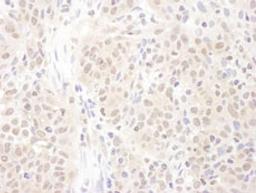 Detection of human PSME4 by immunohistochemistry.