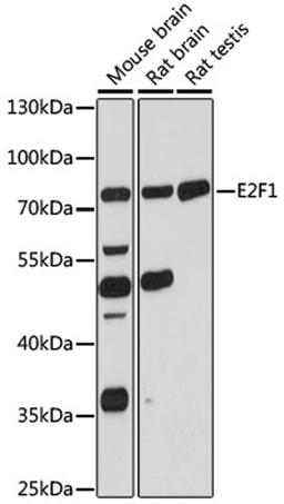 Western blot - E2F1 antibody (A16720)