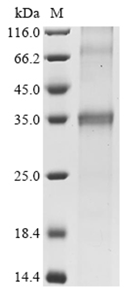 (Tris-Glycine gel) Discontinuous SDS-PAGE (reduced) with 5% enrichment gel and 15% separation gel.