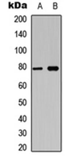 Western blot analysis of Jurkat (Lane 1), mouse brain (Lane 2) whole cell lysates using BCL6 (phospho-S333) antibody