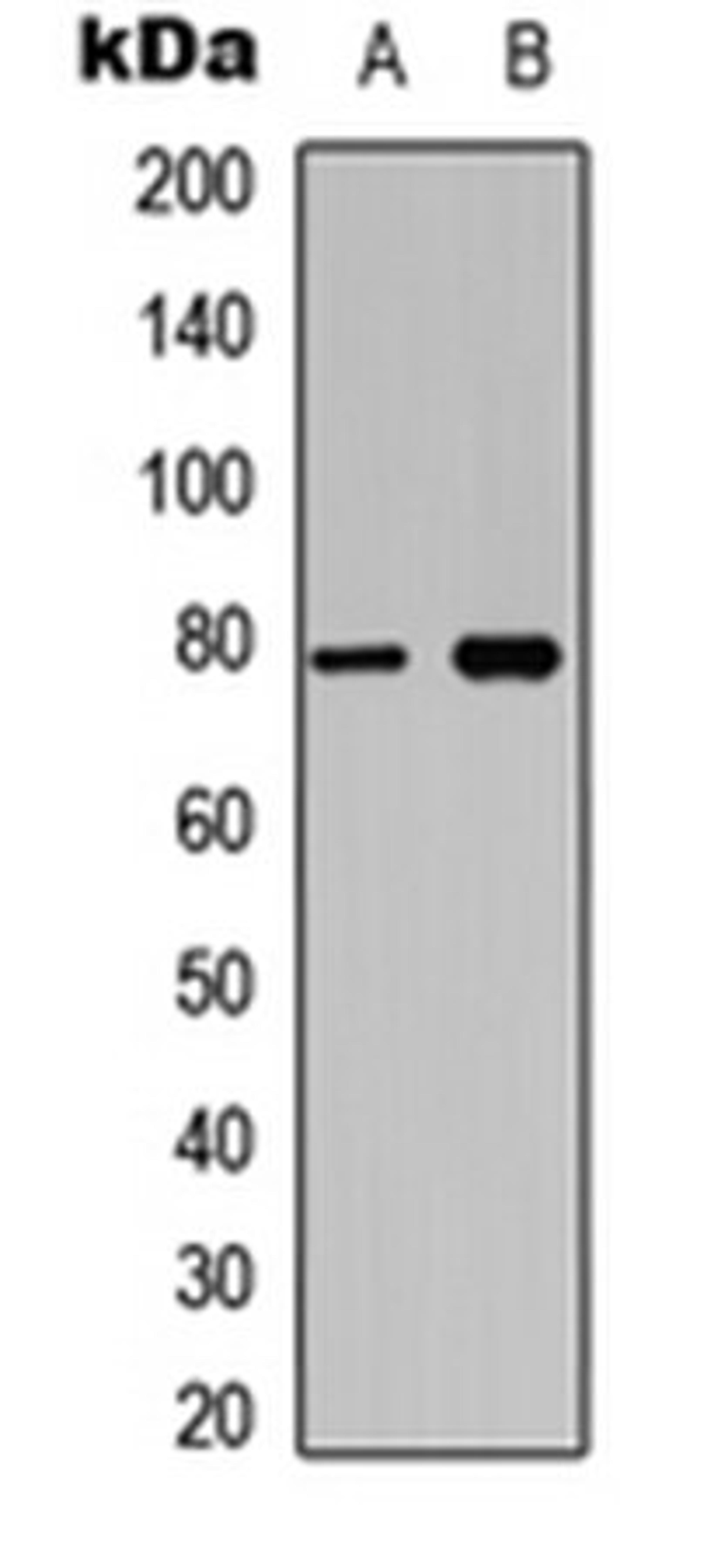 Western blot analysis of Jurkat (Lane 1), mouse brain (Lane 2) whole cell lysates using BCL6 (phospho-S333) antibody