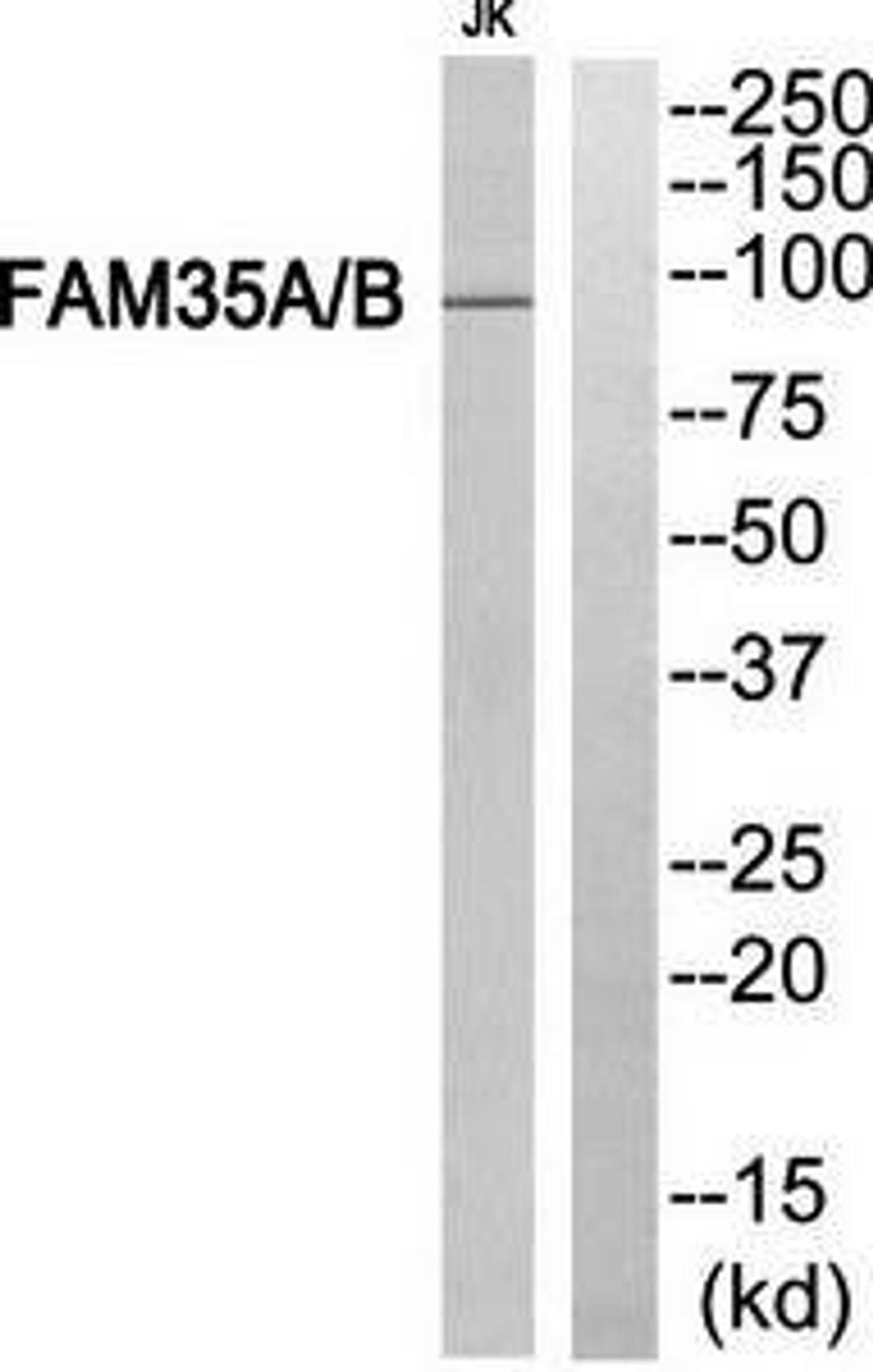 Western blot analysis of extracts from Jurkat cells using FAM35A-B antibody