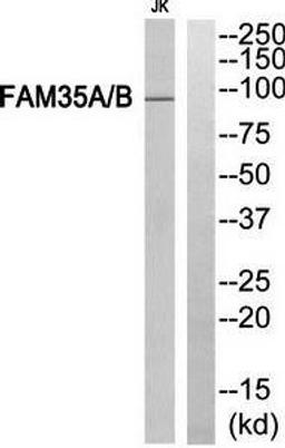 Western blot analysis of extracts from Jurkat cells using FAM35A-B antibody