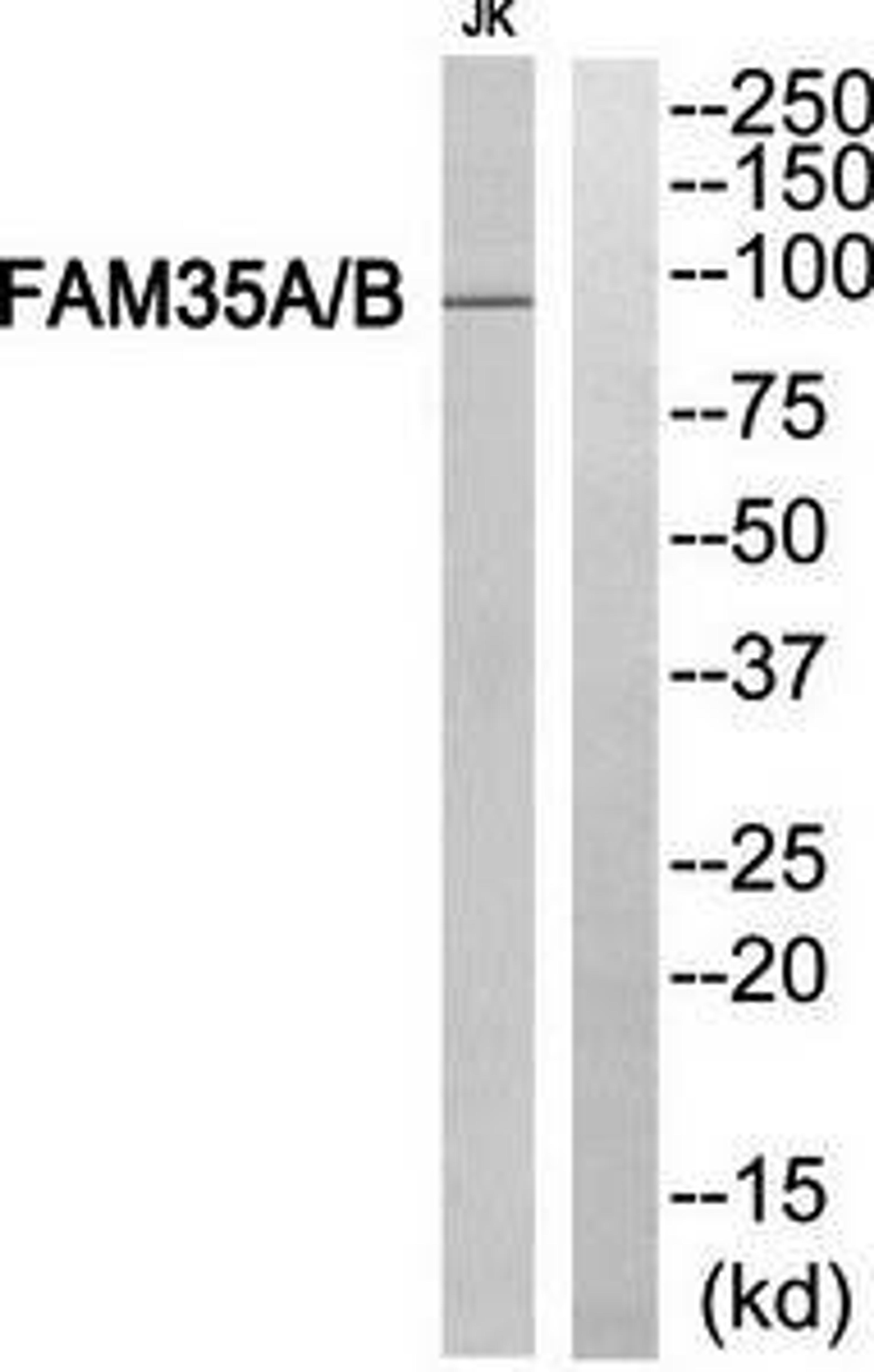 Western blot analysis of extracts from Jurkat cells using FAM35A-B antibody