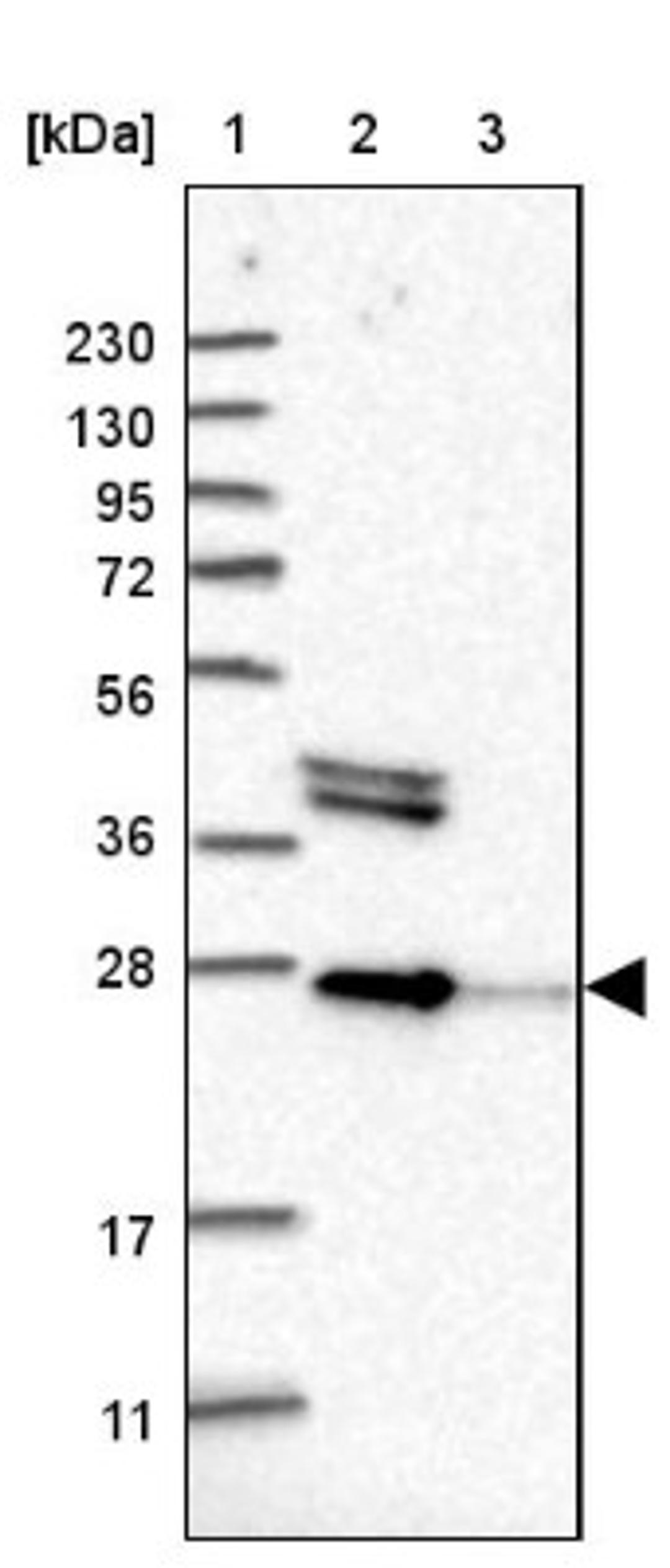 Western Blot: OSTF1 Antibody [NBP2-13718] - Lane 1: Marker [kDa] 230, 130, 95, 72, 56, 36, 28, 17, 11<br/>Lane 2: Human cell line RT-4<br/>Lane 3: Human cell line U-251MG sp