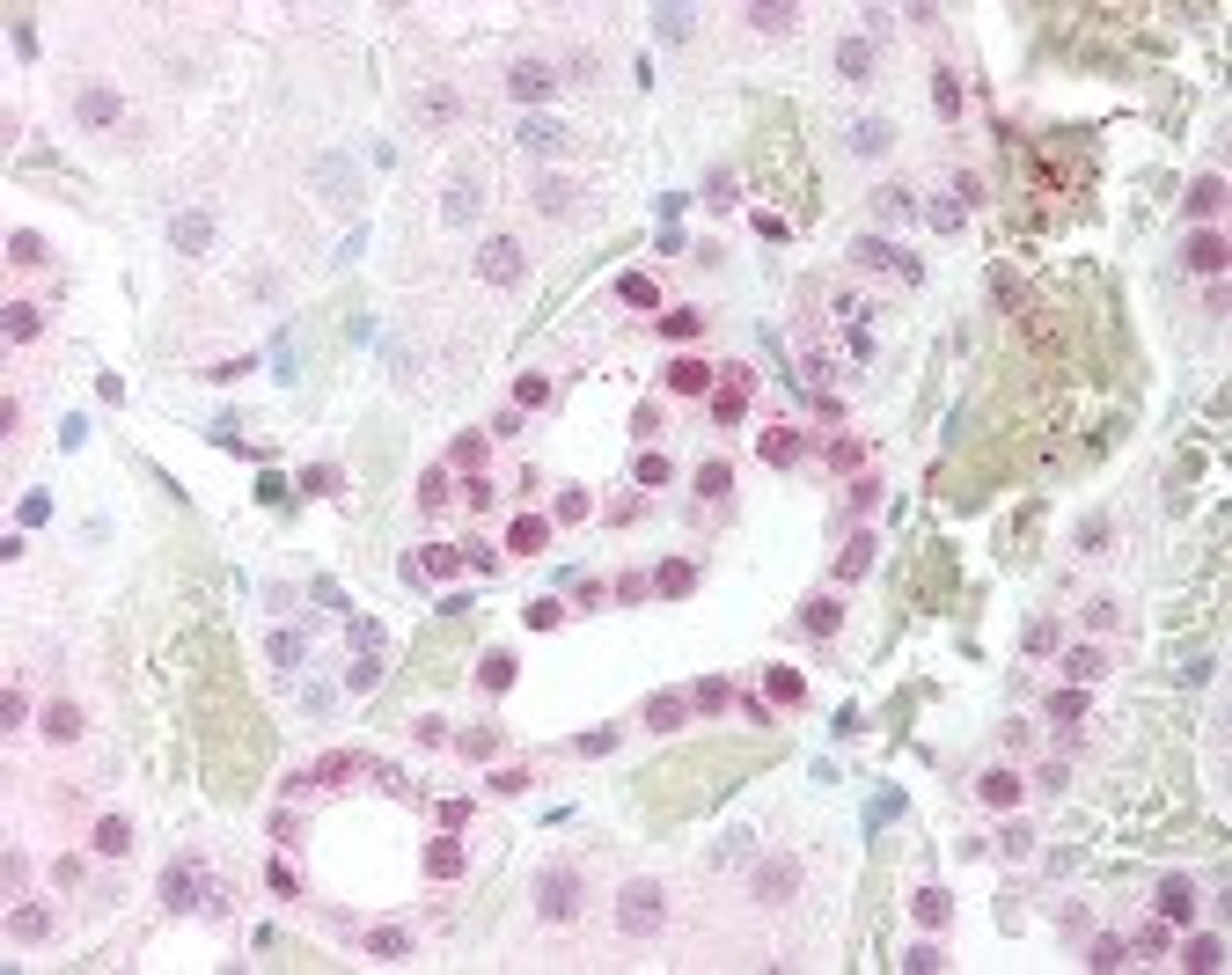 Immunohistochemistry staining of CHUK in kidney tissue using CHUK Antibody.