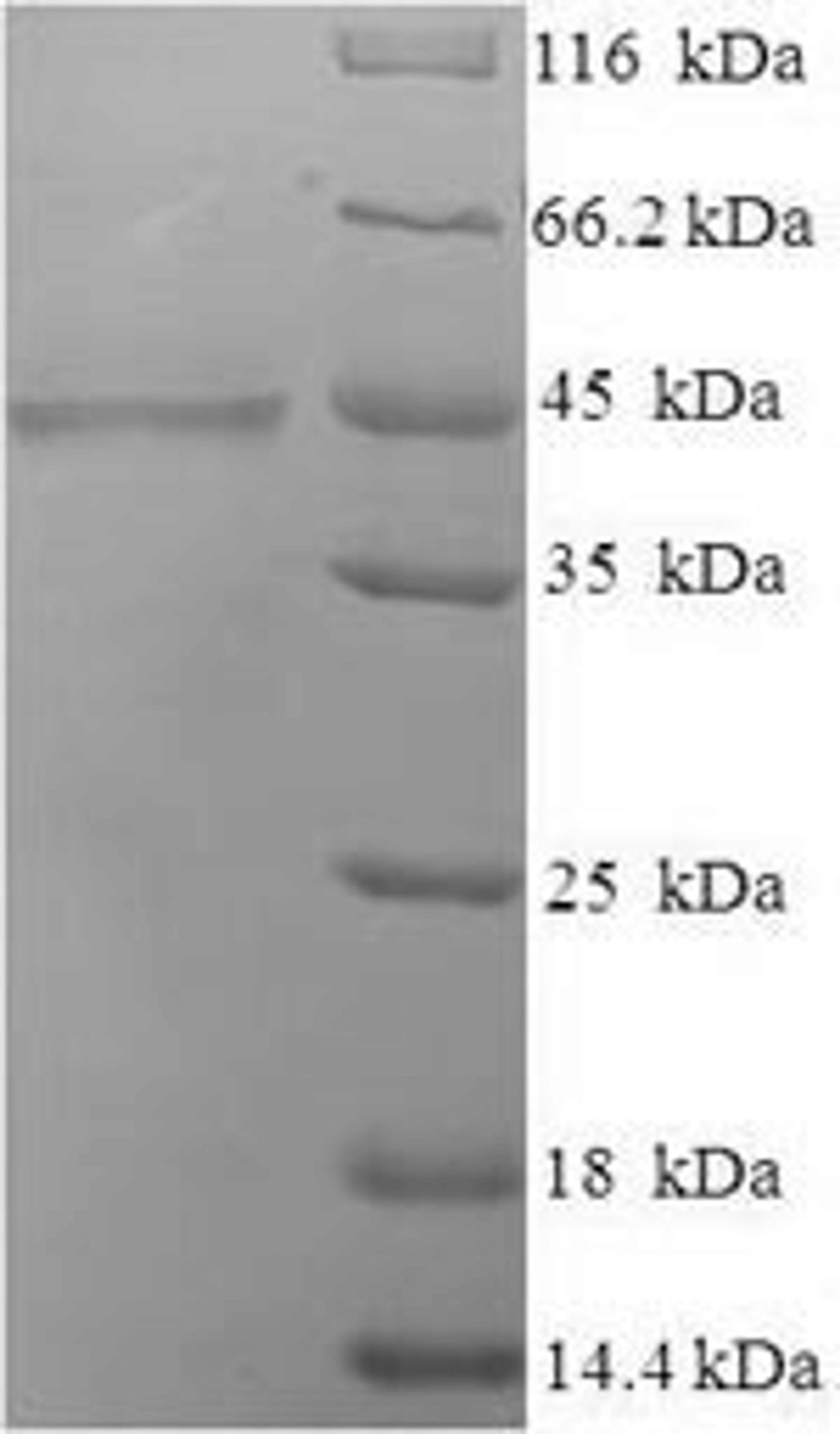 (Tris-Glycine gel) Discontinuous SDS-PAGE (reduced) with 5% enrichment gel and 15% separation gel.