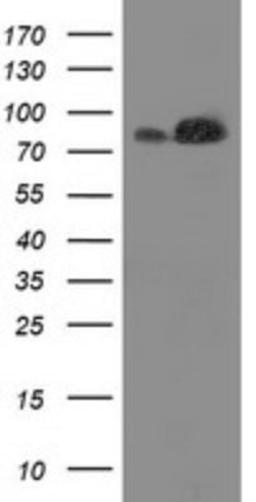 Western Blot: STRIP1 Antibody (7B8) [NBP2-45715] - Analysis of HEK293T cells were transfected with the pCMV6-ENTRY control (Left lane) or pCMV6-ENTRY STRIP1.