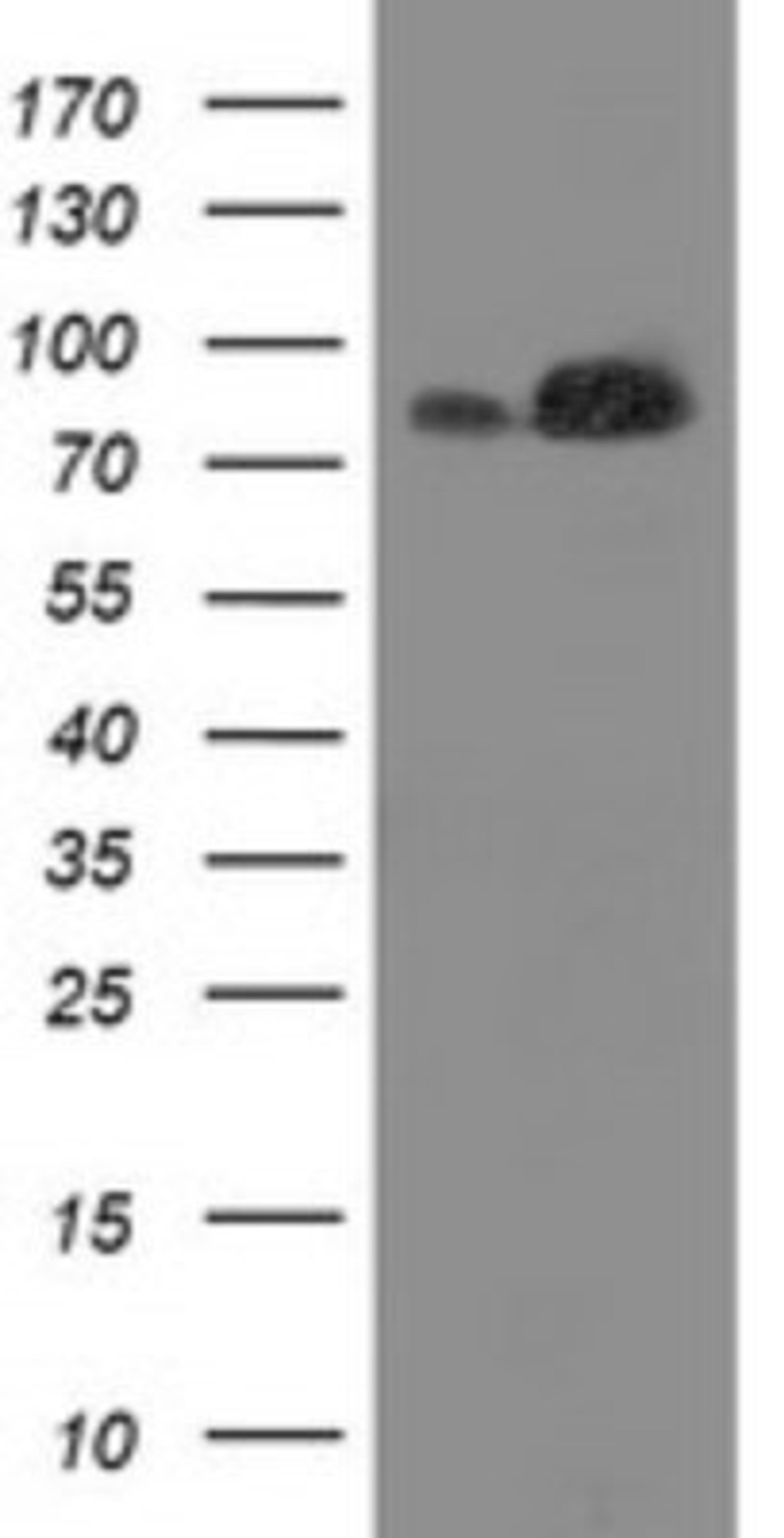 Western Blot: STRIP1 Antibody (7B8) [NBP2-45715] - Analysis of HEK293T cells were transfected with the pCMV6-ENTRY control (Left lane) or pCMV6-ENTRY STRIP1.