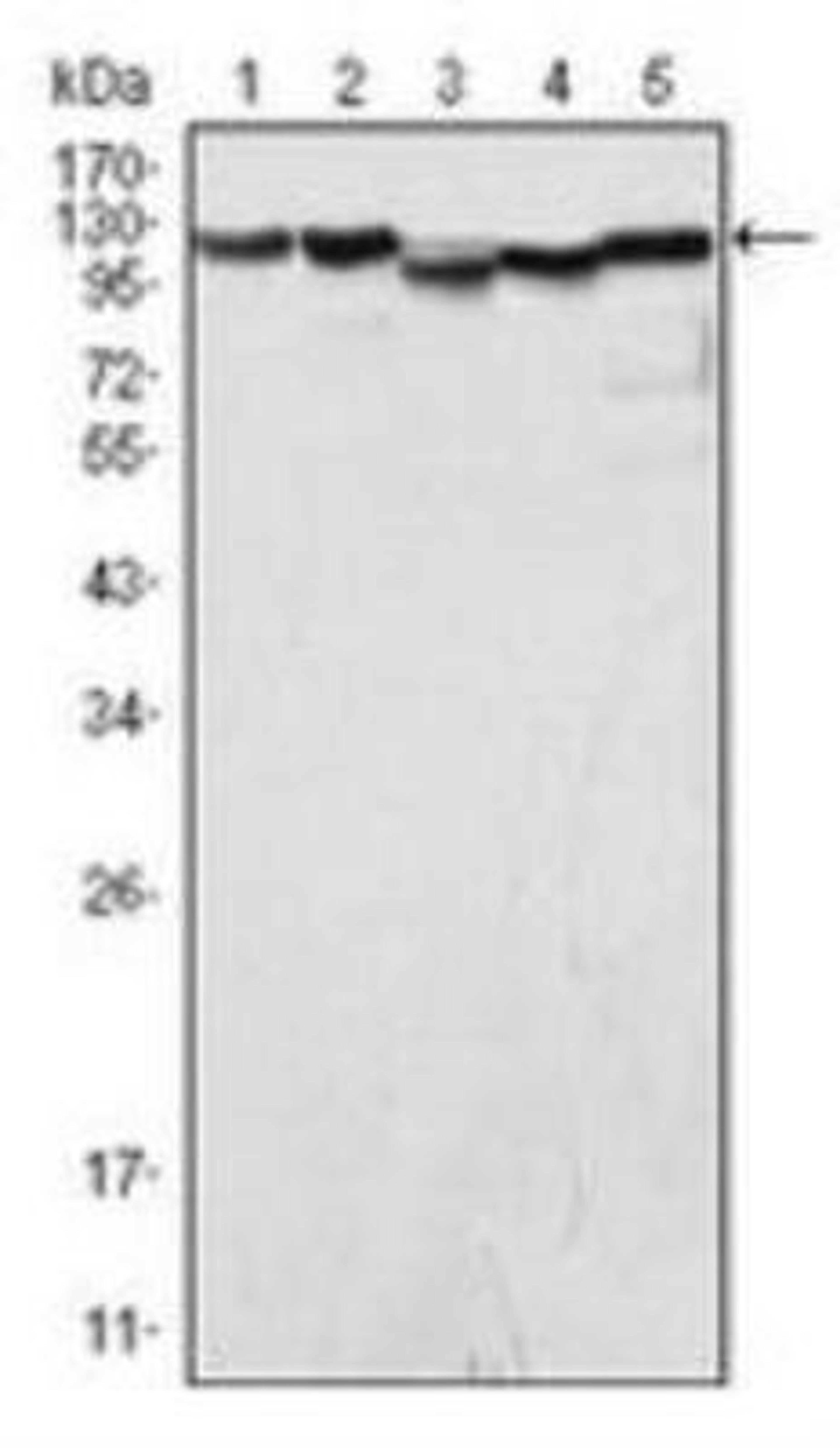 Western Blot: LSD1 Antibody (1B2E5) [NB100-1762] - Western blot analysis using LSD1 mouse mAb against COS (1), Hela (2), NIH/3T3 (3), A549 (4) and Jurkat (5) cell lysate.