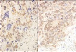 Detection of human and mouse Cul2 by immunohistochemistry.