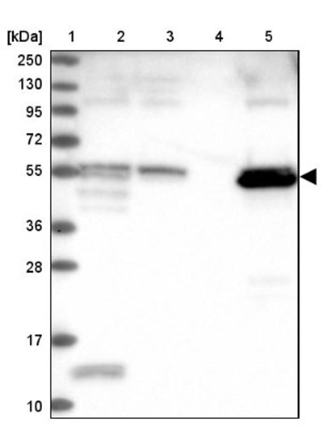 Western Blot: PET112L Antibody [NBP1-80925] - Lane 1: Marker [kDa] 250, 130, 95, 72, 55, 36, 28, 17, 10<br/>Lane 2: Human cell line RT-4<br/>Lane 3: Human cell line U-251MG sp<br/>Lane 4: Human plasma (IgG/HSA depleted)<br/>Lane 5: Human liver tissue