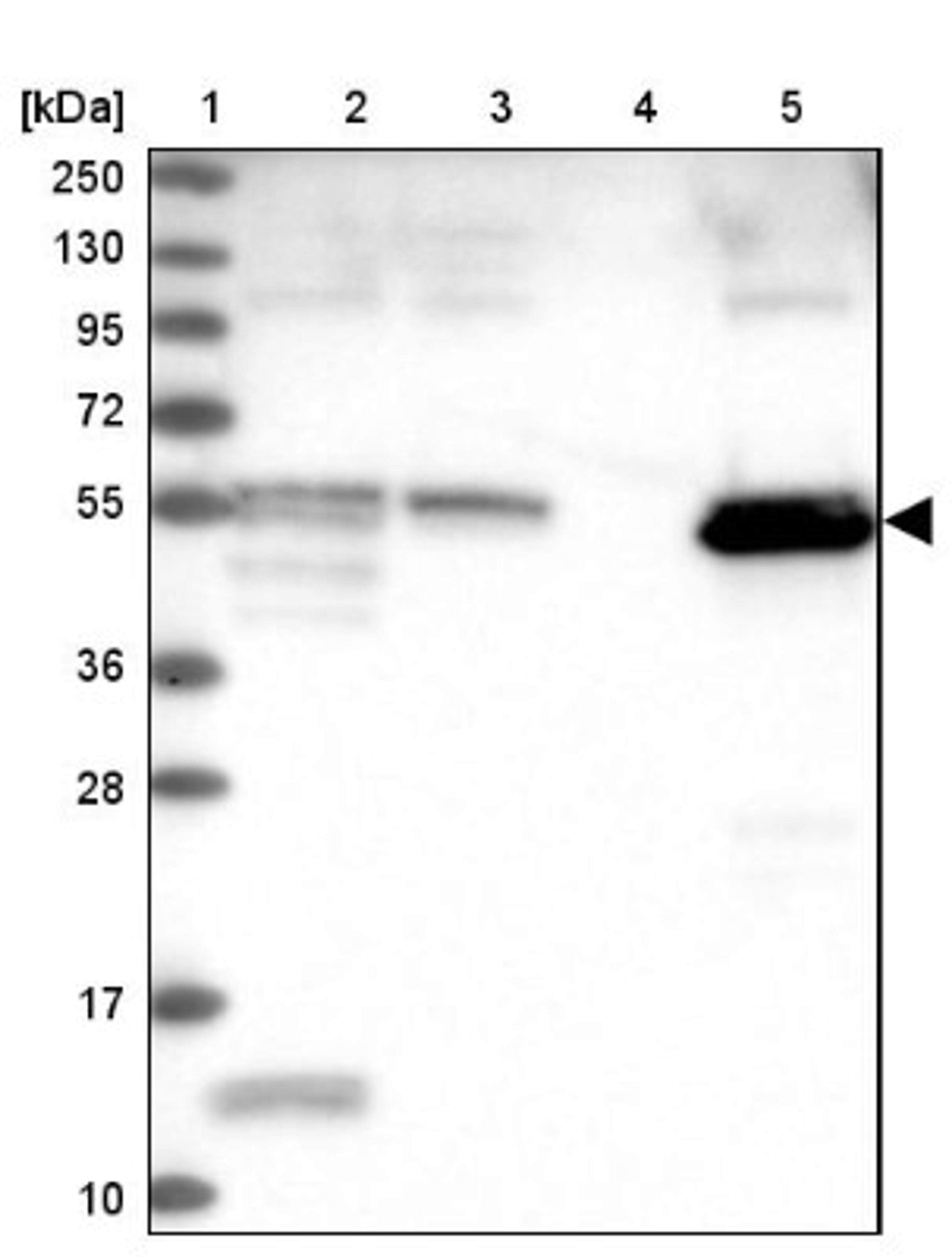 Western Blot: PET112L Antibody [NBP1-80925] - Lane 1: Marker [kDa] 250, 130, 95, 72, 55, 36, 28, 17, 10<br/>Lane 2: Human cell line RT-4<br/>Lane 3: Human cell line U-251MG sp<br/>Lane 4: Human plasma (IgG/HSA depleted)<br/>Lane 5: Human liver tissue