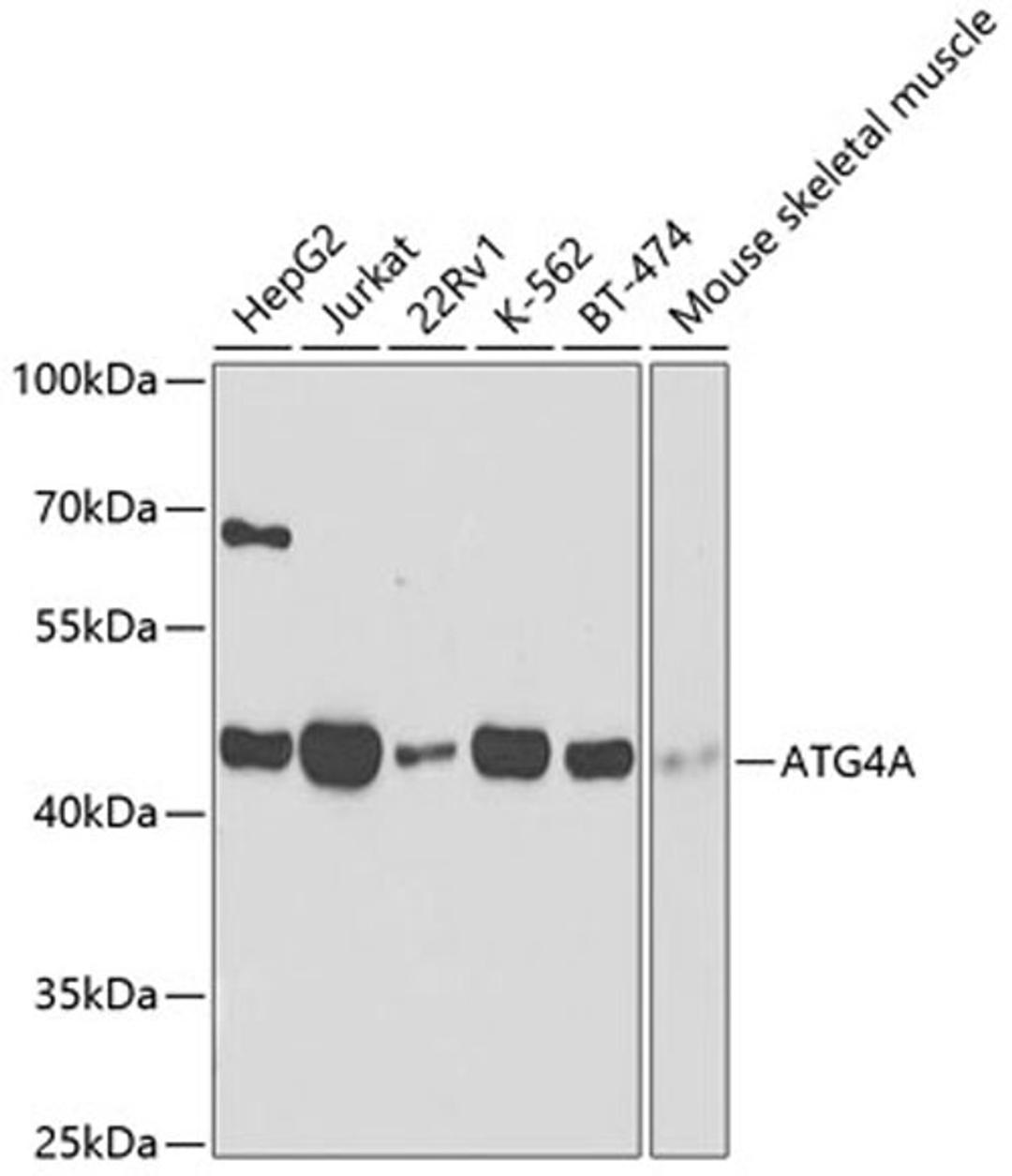 Western blot - ATG4A antibody (A2598)