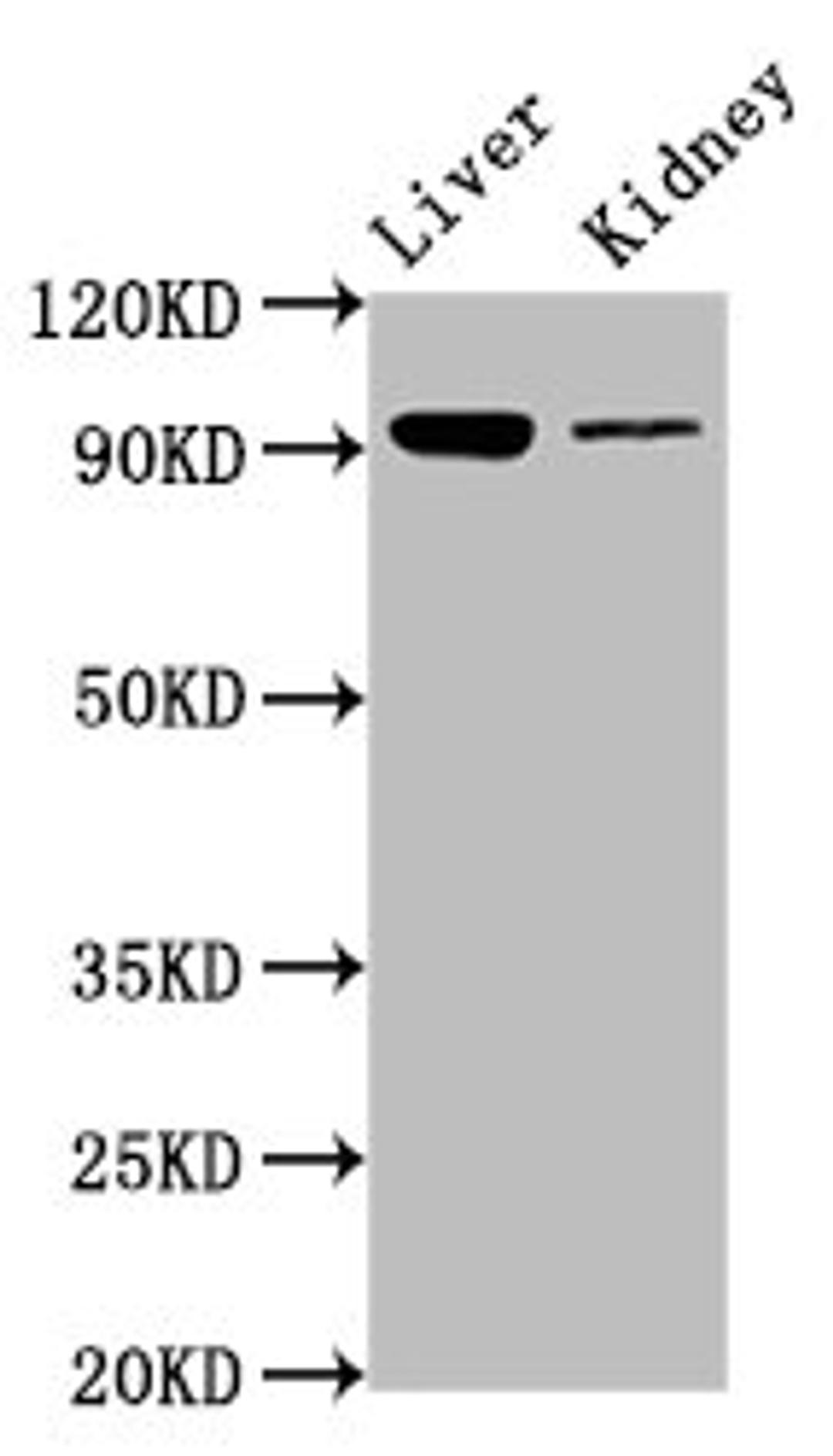 Western Blot. Positive WB detected in: Mouse liver tissue, Mouse kidney tissue. All lanes: DMGDH antibody at 6.7ug/ml. Secondary. Goat polyclonal to rabbit IgG at 1/50000 dilution. Predicted band size: 97, 46 kDa. Observed band size: 97 kDa. 