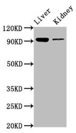 Western Blot. Positive WB detected in: Mouse liver tissue, Mouse kidney tissue. All lanes: DMGDH antibody at 6.7ug/ml. Secondary. Goat polyclonal to rabbit IgG at 1/50000 dilution. Predicted band size: 97, 46 kDa. Observed band size: 97 kDa. 