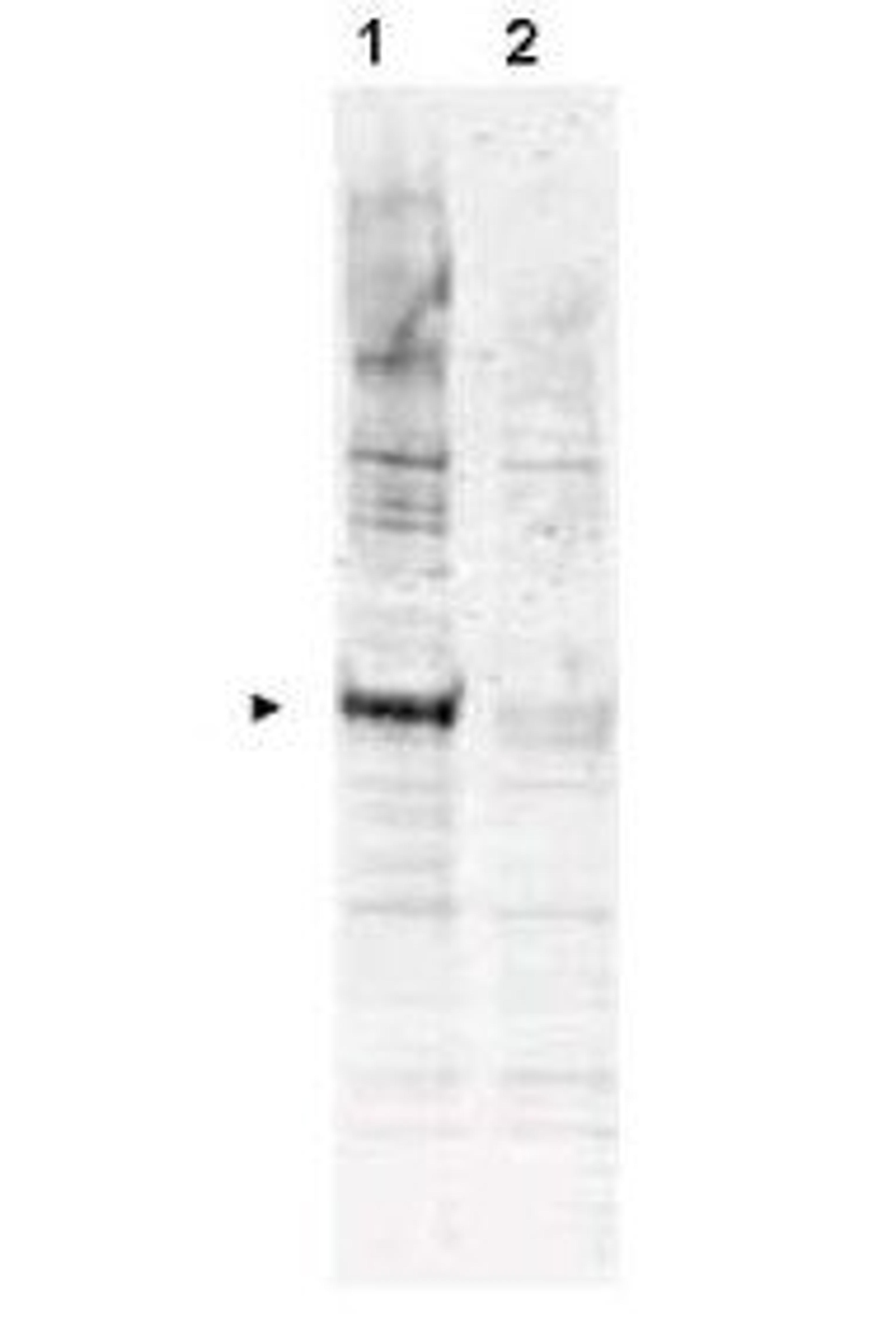 Western blot analysis of nocodazole treated HeLa whole cell lysate (Lane1), Reactivity is not seen in lysates from asynchronous HeLa whole cell cultures (Lane2) using APC6 (phospho-T580) antibody