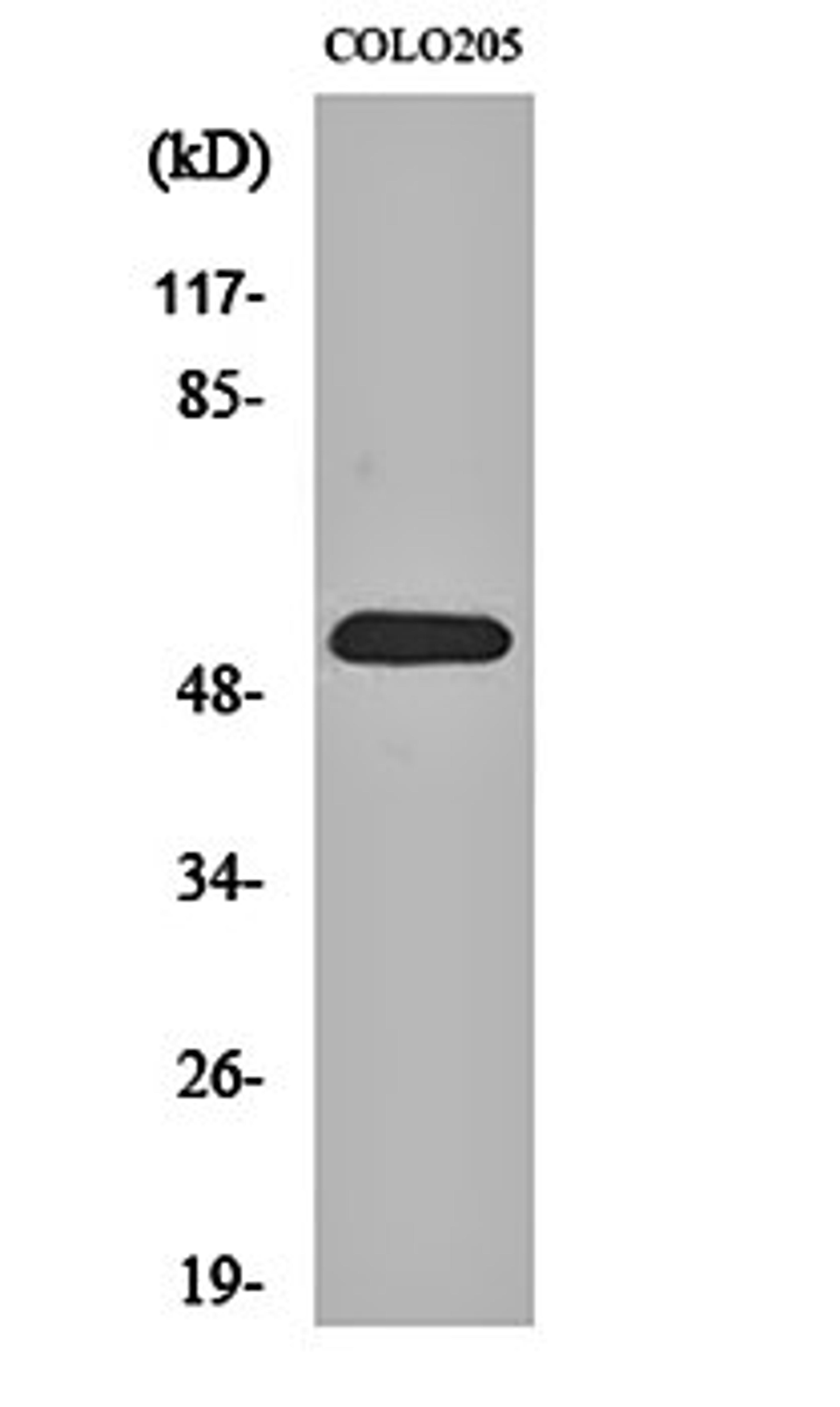 Western blot analysis of COLO205 cell lysates using HisRS antibody