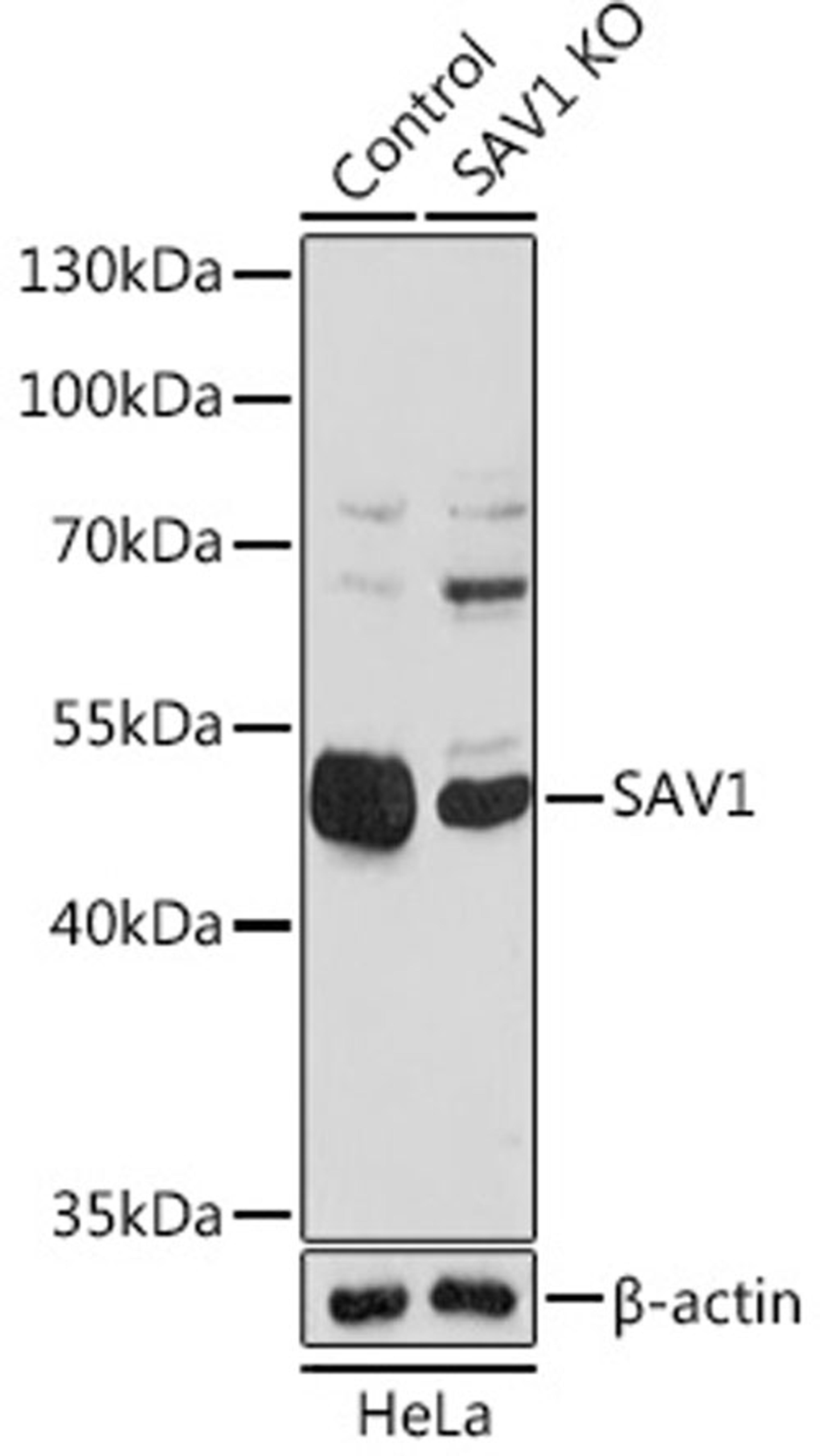 Western blot - [KO Validated] SAV1 antibody (A18667)