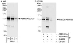 Detection of human RBM25/RED120 by western blot and immunoprecipitation.