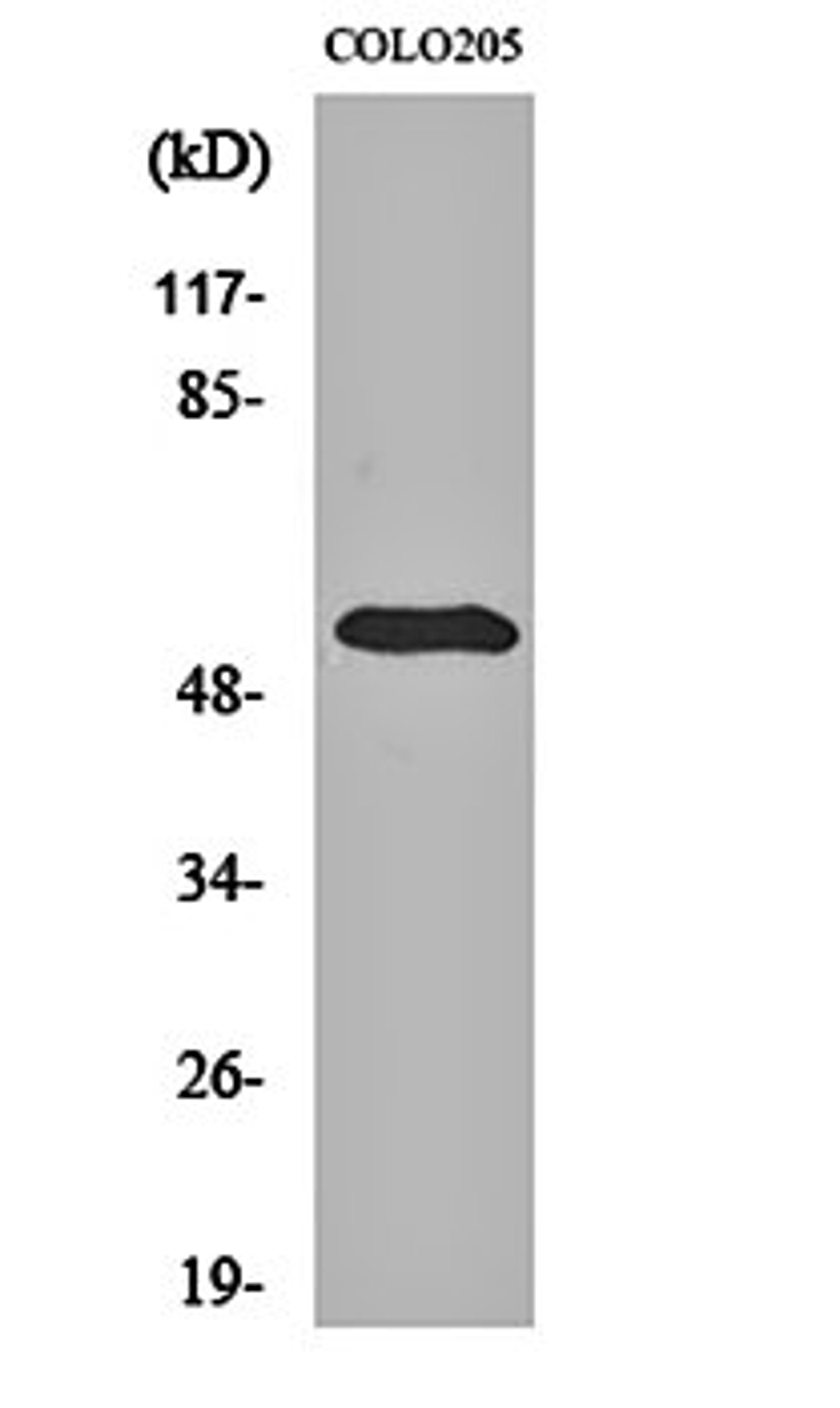 Western blot analysis of COLO205 cell lysates using pHyde antibody