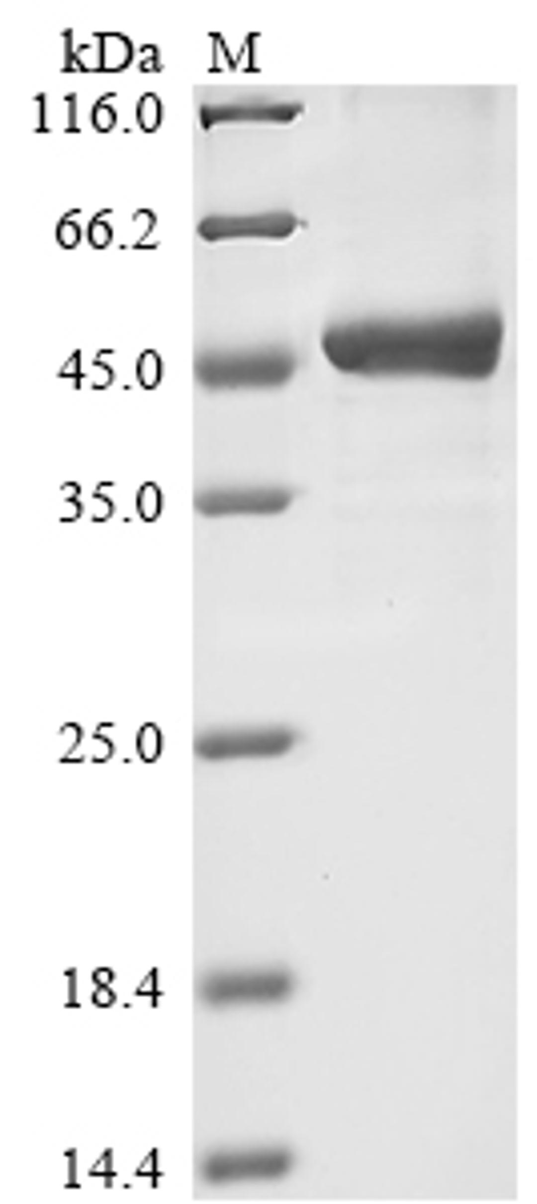 (Tris-Glycine gel) Discontinuous SDS-PAGE (reduced) with 5% enrichment gel and 15% separation gel.