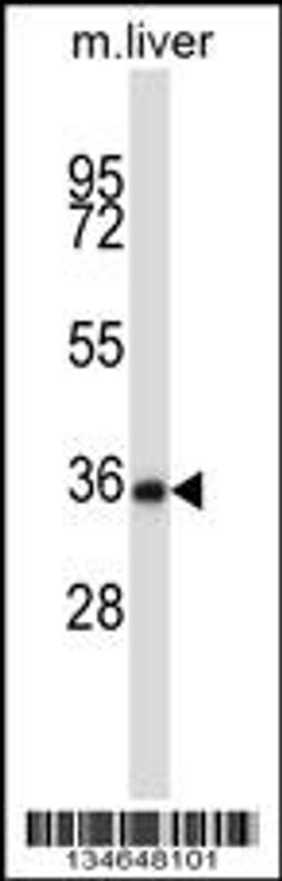 Western blot analysis in mouse liver tissue lysates (35ug/lane).