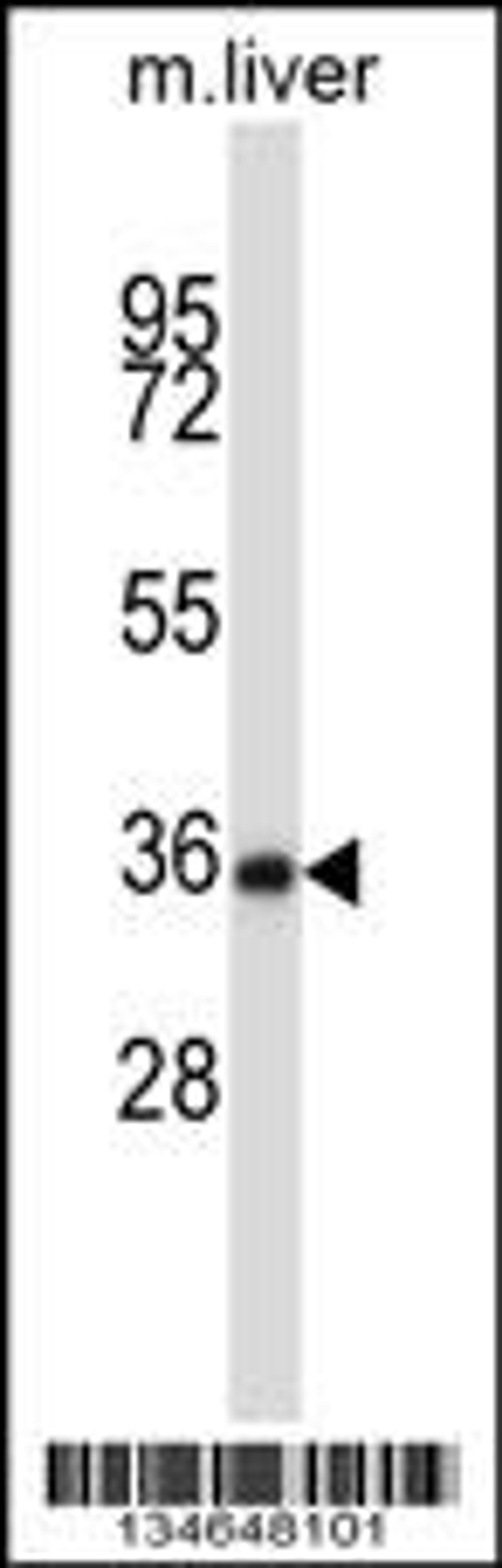 Western blot analysis in mouse liver tissue lysates (35ug/lane).