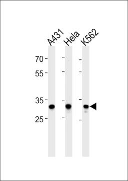 Western blot analysis in A431,Hela,K562 cell line lysates (35ug/lane).