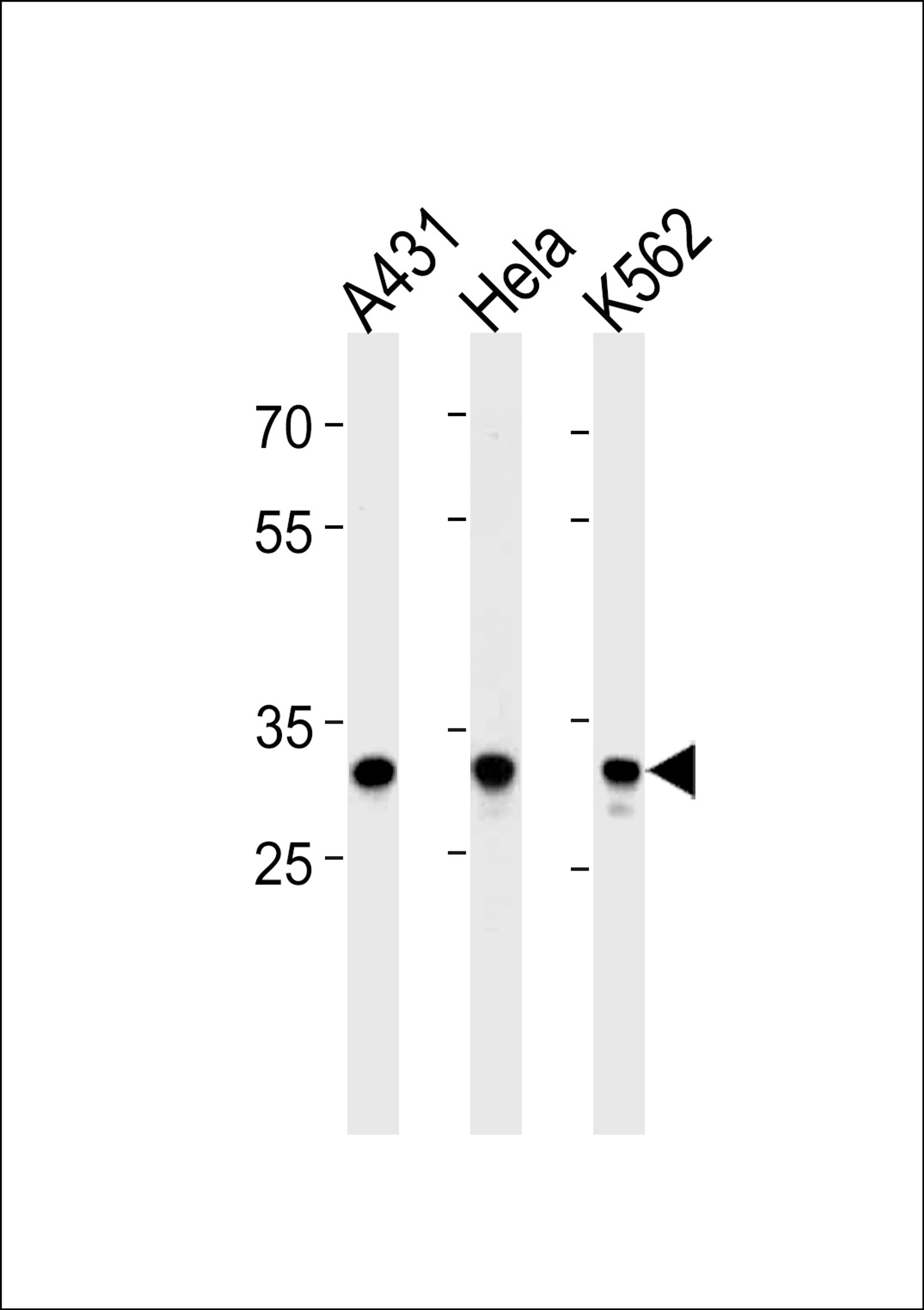 Western blot analysis in A431,Hela,K562 cell line lysates (35ug/lane).