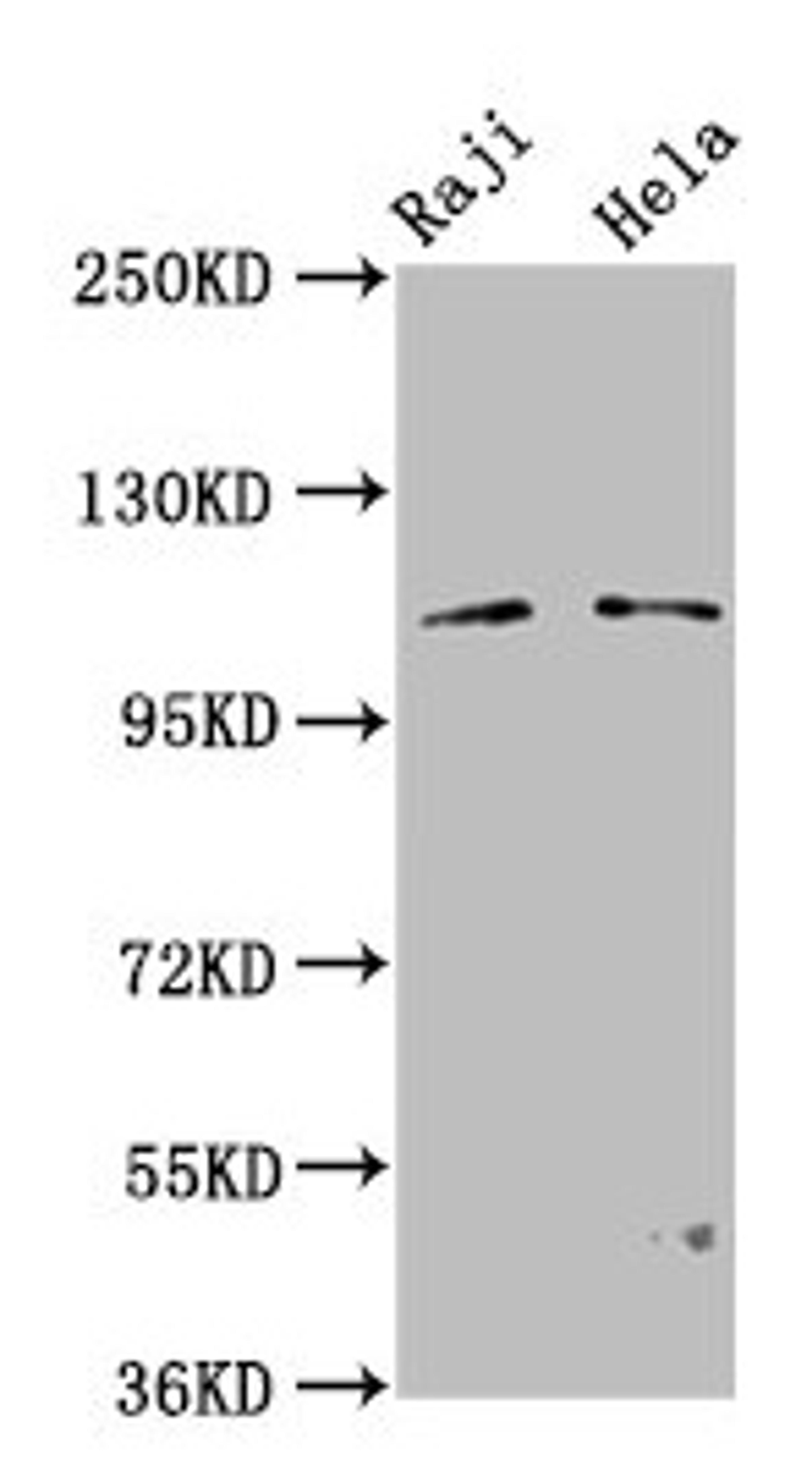 Western Blot. Positive WB detected in: Raji whole cell lysate, Hela whole cell lysate. All lanes: PACS1 antibody at 3.2µg/ml. Secondary. Goat polyclonal to rabbit IgG at 1/50000 dilution. Predicted band size: 105, 110 kDa. Observed band size: 110 kDa