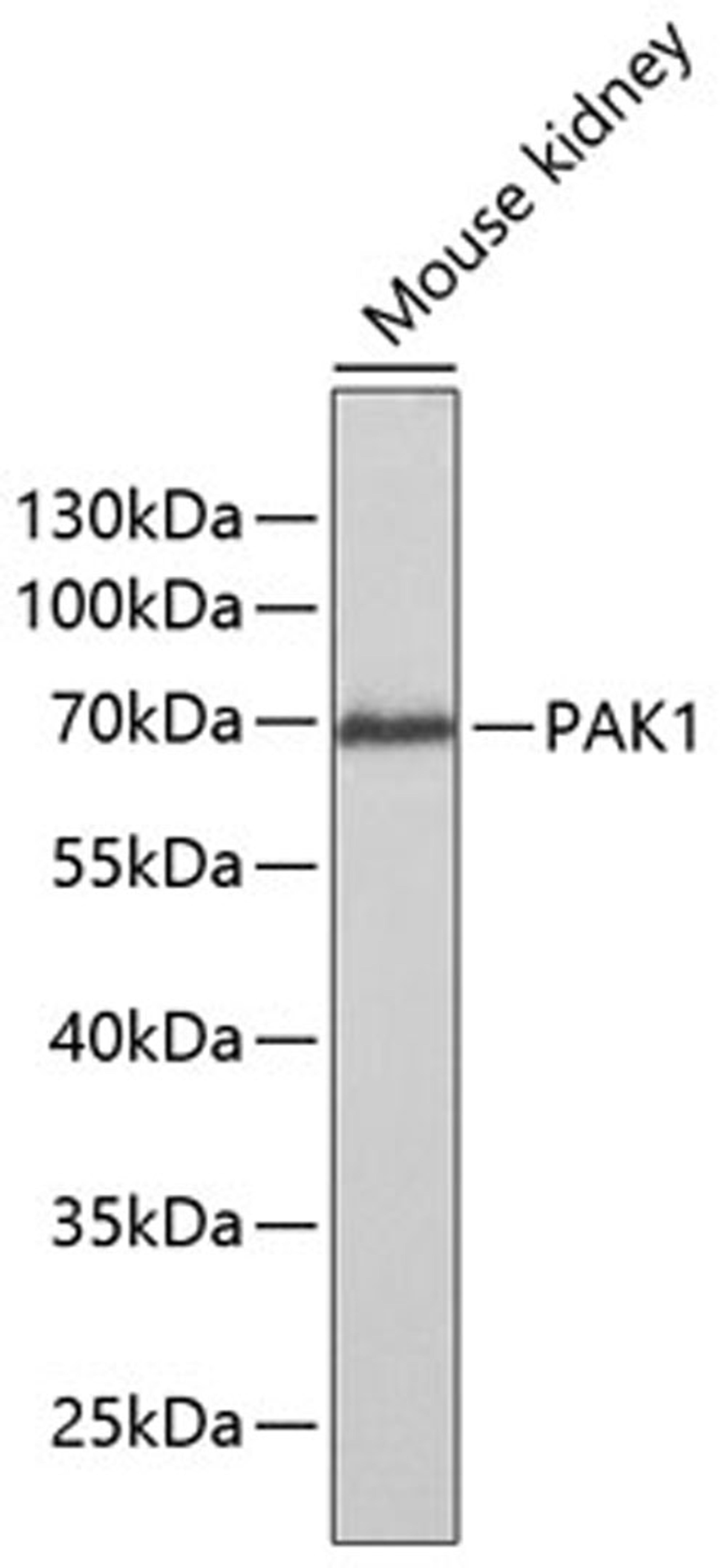 Western blot - PAK1 antibody (A2554)