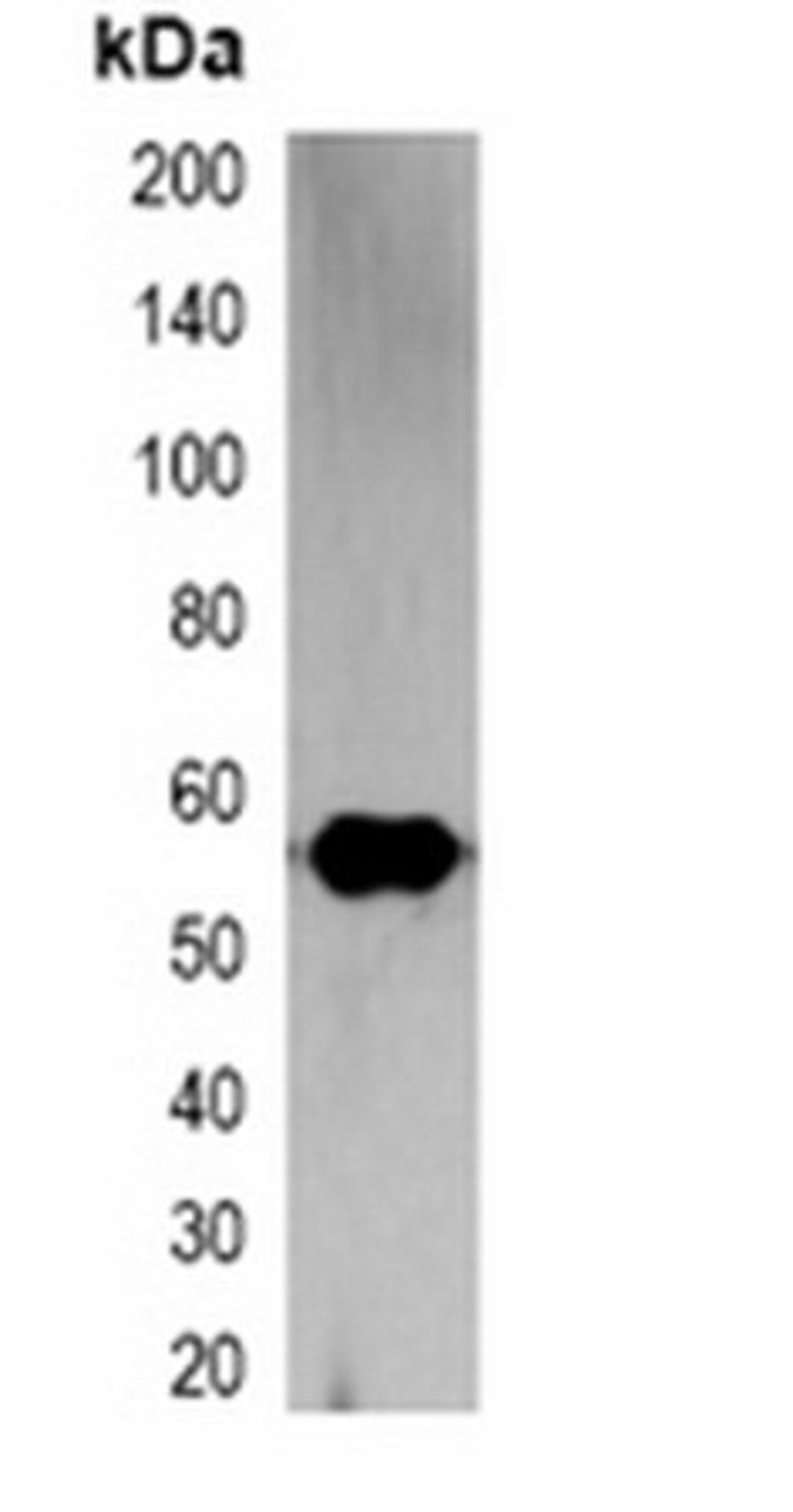 Western blot analysis of 293T cell lysate using RFP-tag antibody