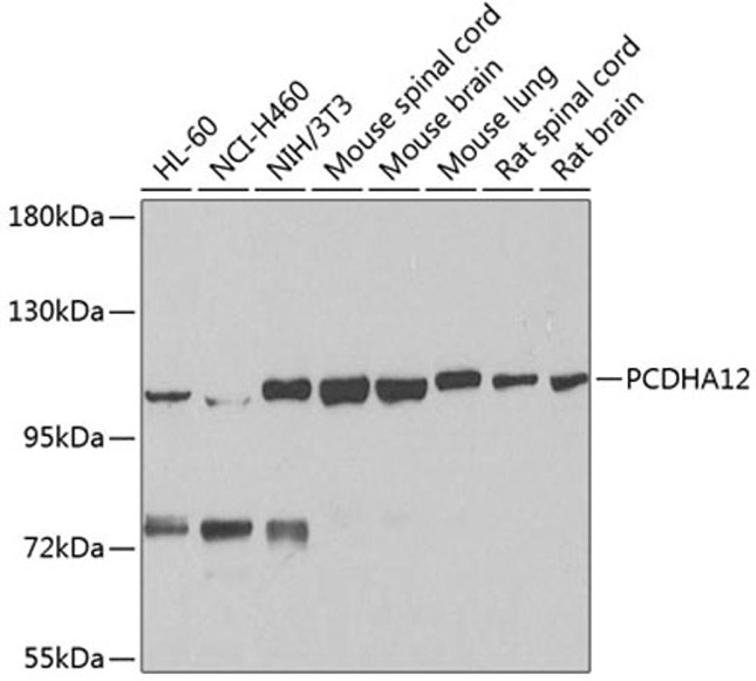 Western blot - PCDHA12 antibody (A8501)