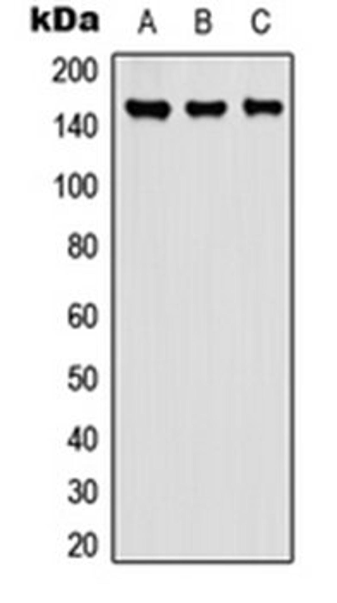 Western blot analysis of A549 (Lane 1), NS-1 (Lane 2), PC12 (Lane 3) whole cell lysates using Carboxypeptidase D antibody