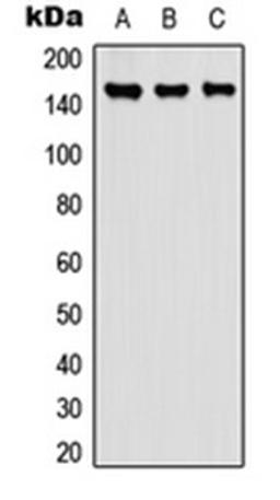 Western blot analysis of A549 (Lane 1), NS-1 (Lane 2), PC12 (Lane 3) whole cell lysates using Carboxypeptidase D antibody