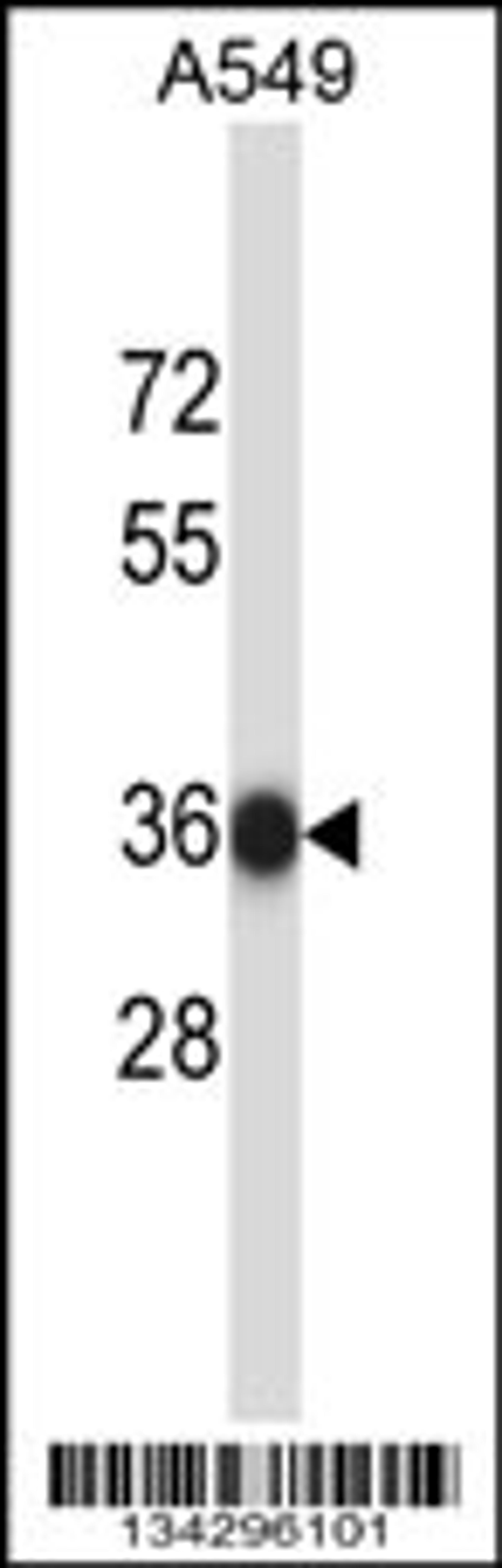 Western blot analysis in A549 cell line lysates (35ug/lane).