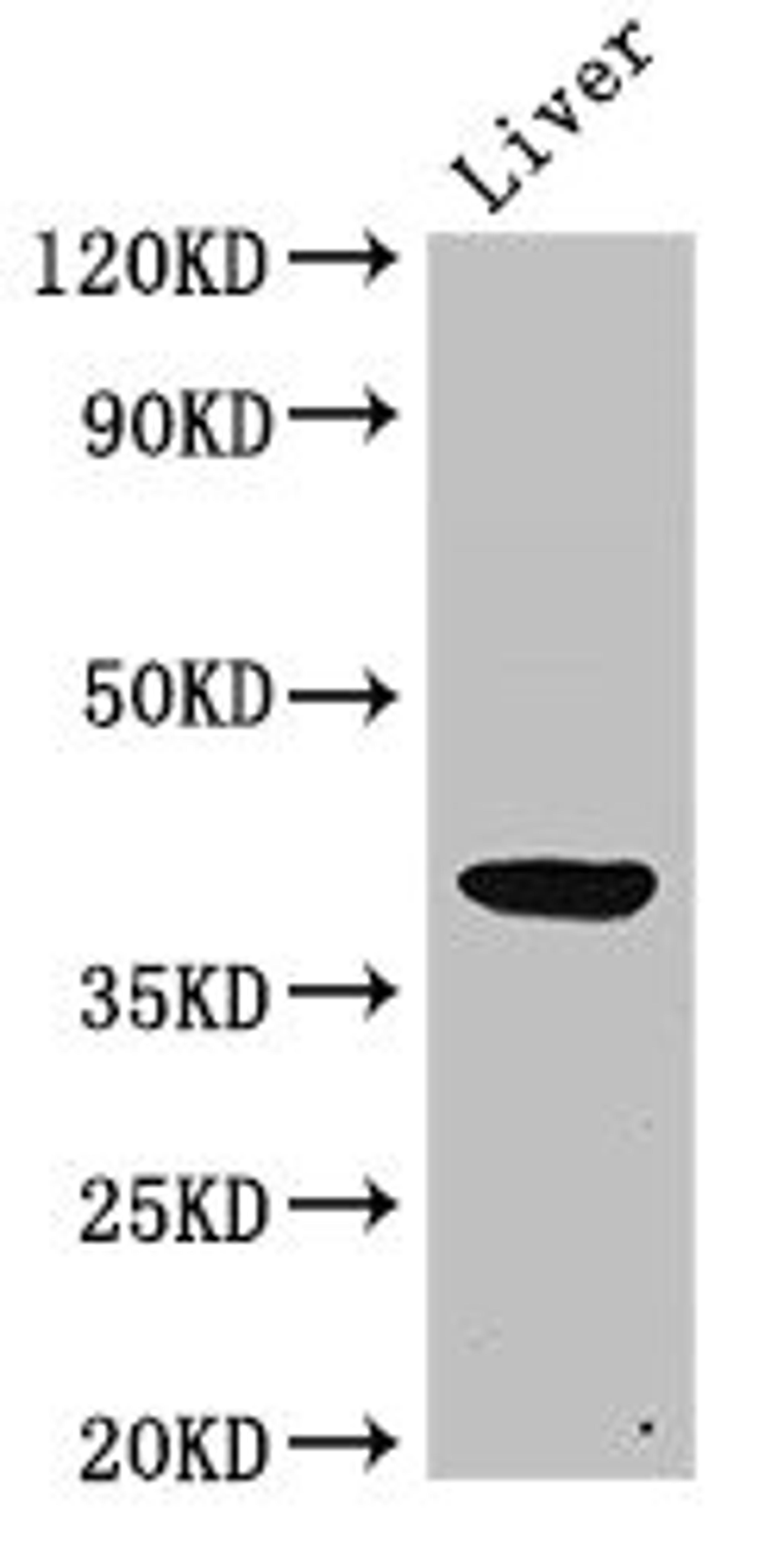 Western Blot. Positive WB detected in: Rat liver tissue. All lanes: ADH5 antibody at 2ug/ml. Secondary. Goat polyclonal to rabbit IgG at 1/50000 dilution. Predicted band size: 40 kDa. Observed band size: 40 kDa.